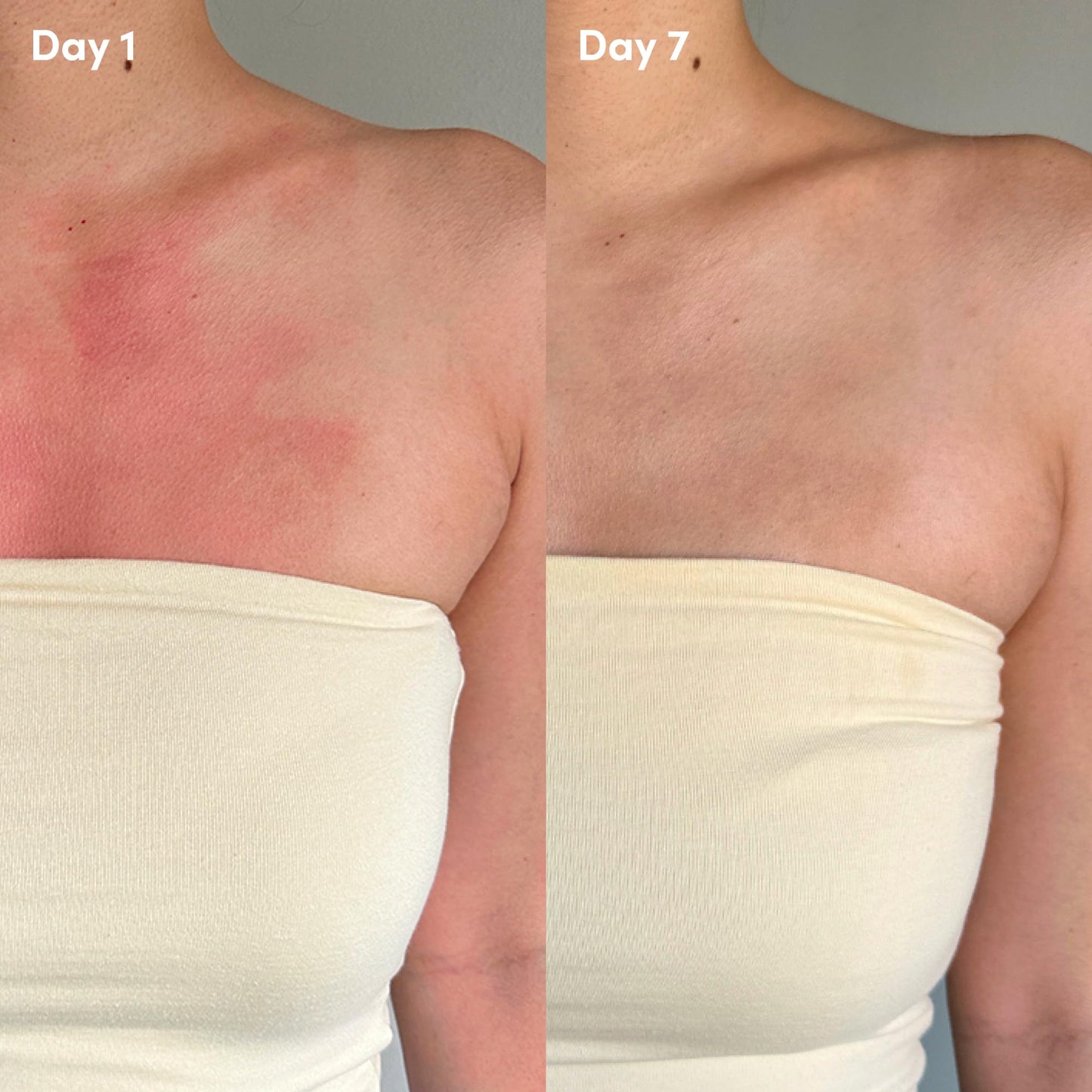 Coco & Eve Firming & Cooling Body Gel Lotion — Aftersun Care with Aloe Vera, Polyglutamic Acid for Sunburn Relief, Hydration & Skin Recovery. Soothing Moisturiser for Sun-irritated Skin. (6.76 fl oz)