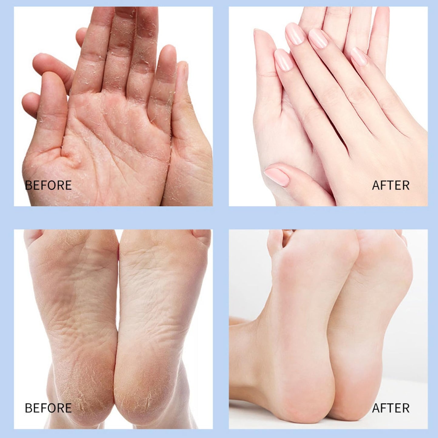 RTQSU Crack Feet Prevention Stick, Anti Crack Foot Cream Stick, Foot Care Cream Cracked Feet, Moisturizing Foot Balm, Softening and Nourishing Cream for For Dry Heels