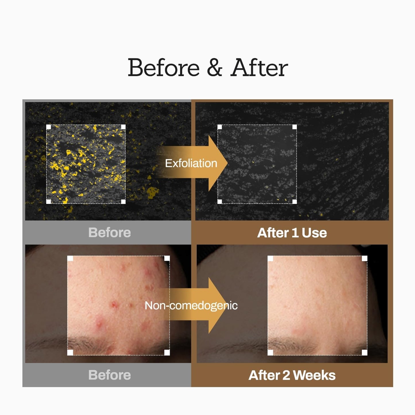 Rice Wash-Off Mask - Korean Glass Skin Face Mask Skincare - Hydrating Rice Clay Mask for Face - Natural Exfoliants Gently Improve Skin Texture, Even Skin Tone, and Restore Radiant Glow, 6.76 fl.oz