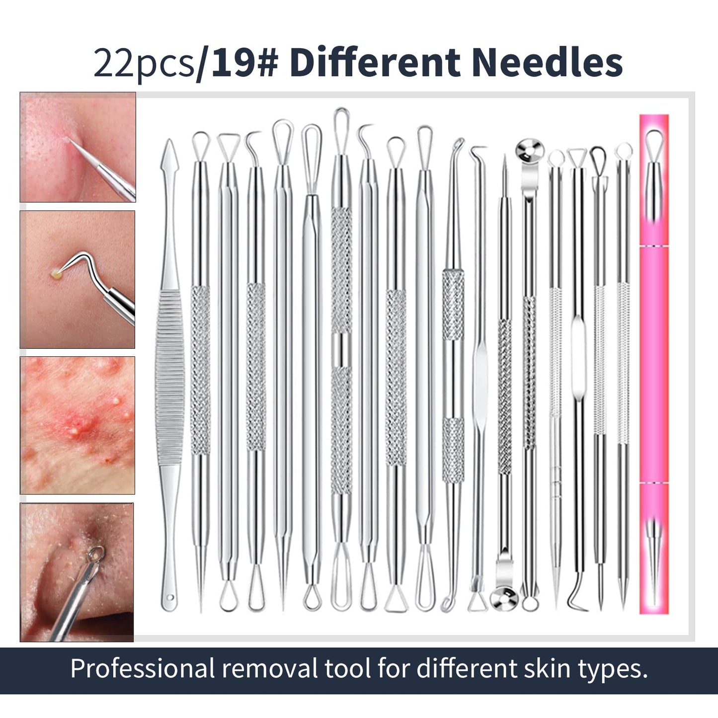 2025 Professional Pimple Popper Tool Kit - 22 PCS Blackhead Remover Tools for Acne and Zit Popping Comedone Extractor with Magnifying Glass