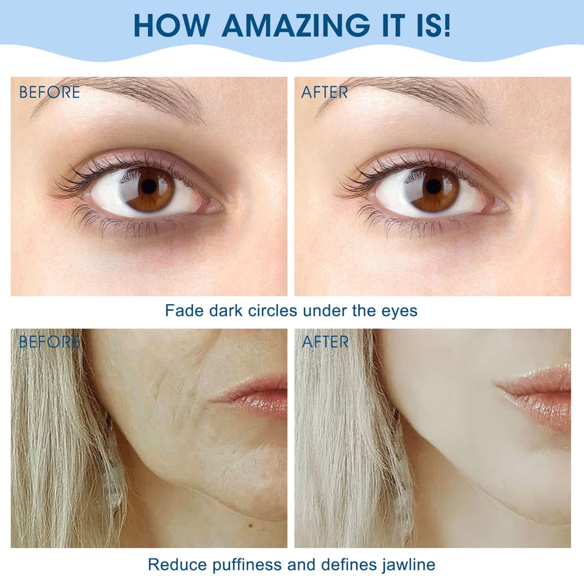 Bealihelp Face Roller & Gua Sha, Stainless Steel Facial Roller and Gua Sha Tool for Face, Skin Care, Anti-Aging, and Lifting