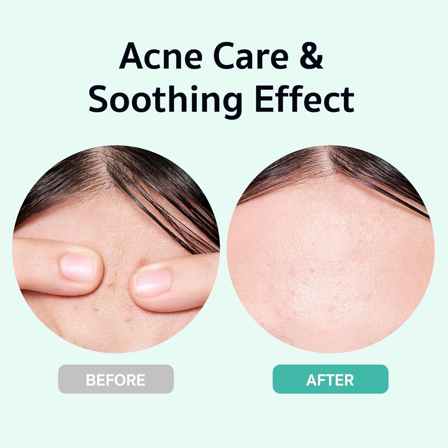 BRING GREEN X NETFLIX SQUID GAME Edition Zinc Teca Serum 25mL | Calming Serum for Skin Soothing & Oil Control | Includes Free Gonggi Tossing Game as Seen in Squid Game