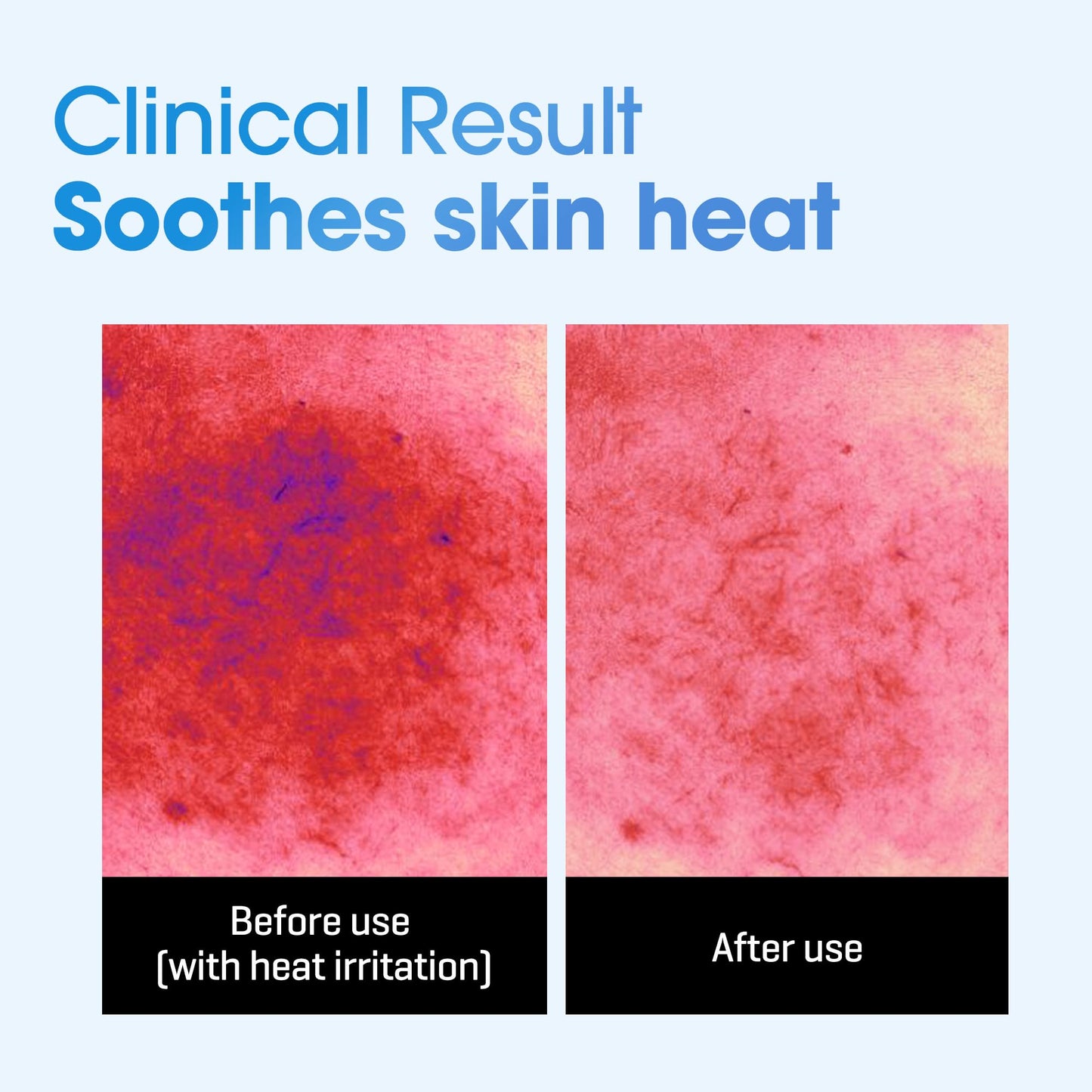 SOME BY MI Beta-Panthenol Repair Daily Mask - 30 Sheets, 11.8Oz - Daily Vegan Korean Face Sheet Mask for Skin Barrier Recovery - Hydrating and Moisturizing Skin Care with Panthenol - Korean Skin Care