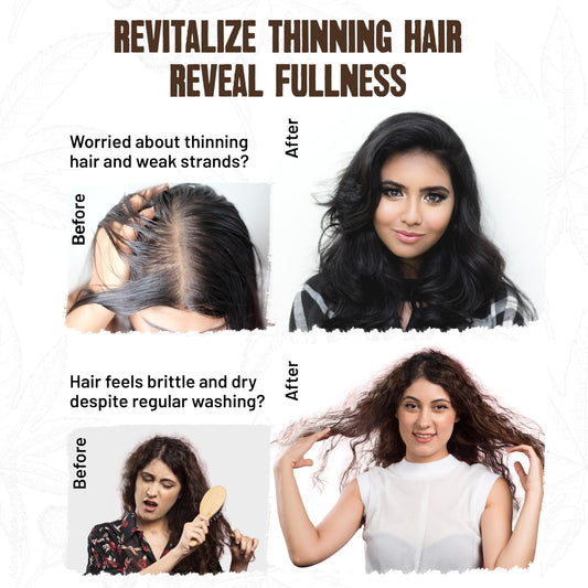 Herbishh Castor Oil Shampoo Bar – Nourishing Solid Shampoo Bar for Hair Growth & Thinning Hair – Castor Oil Soap for Healthy Moisturized Scalp – Natural & Organic Soap for Women & Men 3.53 oz