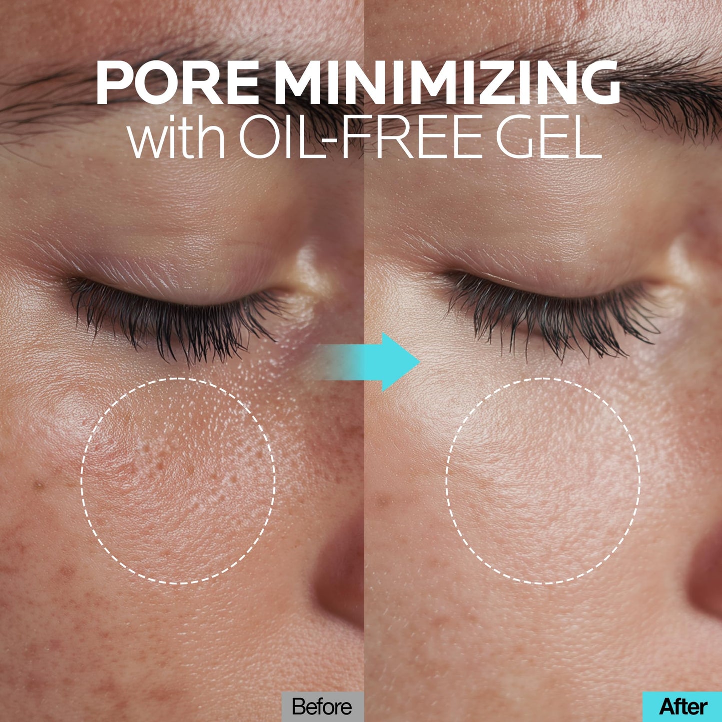 mimmua! Ice Sorbet Soothing Cooling Face Moisturizer | Pore Minimizer for Face Before Makeup | After Sun Care for Sunburn, Heat Rash & Calming Gel Cream After Shower | Korean Skincare | 3.38 Fl Oz