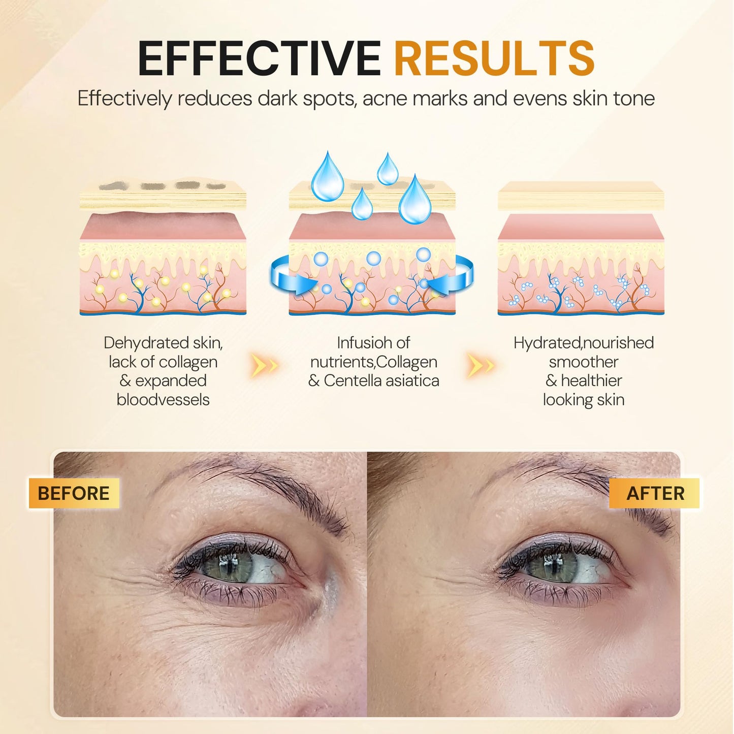 KUTDEP Under Eye Patches, 10 Pairs Gold Collagen Eye Gels Mask, Reduce Dark Circles, Wrinkles Puffy & Bags, Anti-aging Moisturizing Eye Mask