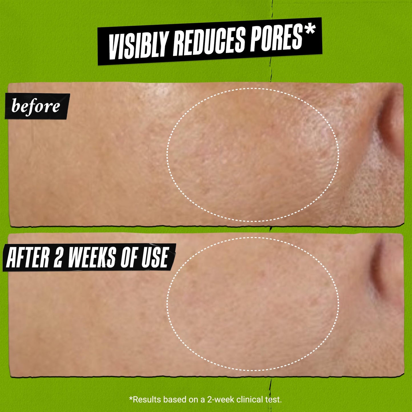 Kiehl's Rare Earth Deep Pore Cleansing Mask, Oil-Minimizing Face Mask for Clogged Pores, Detoxifies & Refines Skin, Absorbs Excess Oil, with Amazonian White Clay & Aloe Vera - 0.95 fl oz