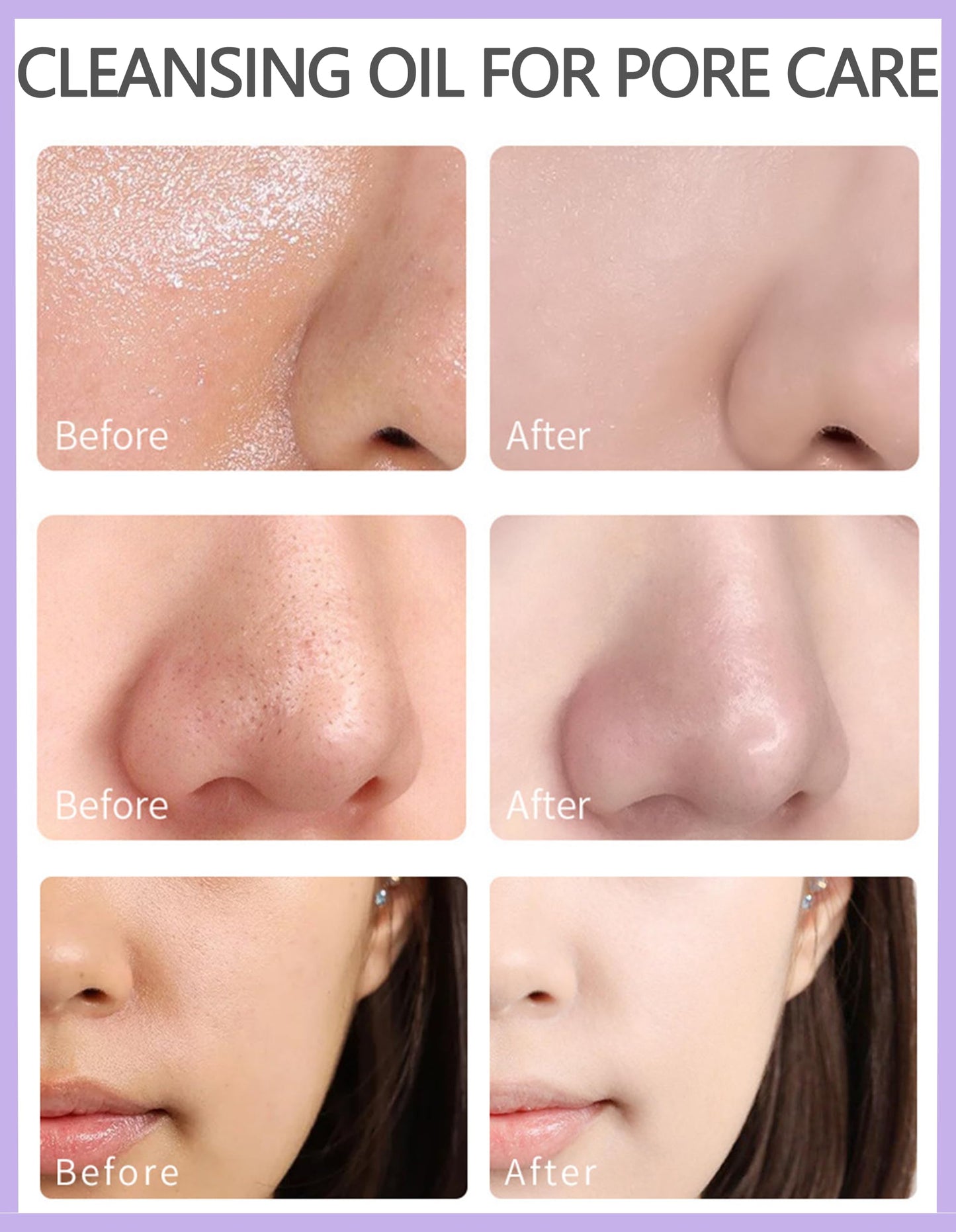 20P Pore Blackhead Cleansing Oil, Mini Makeup Remover Capsule, Face Oil Cleanser with Jojoba & Camellia Extract, | Travel Size, Moisturizing, Freshing, Individually Packaged Travel Essential Makaup