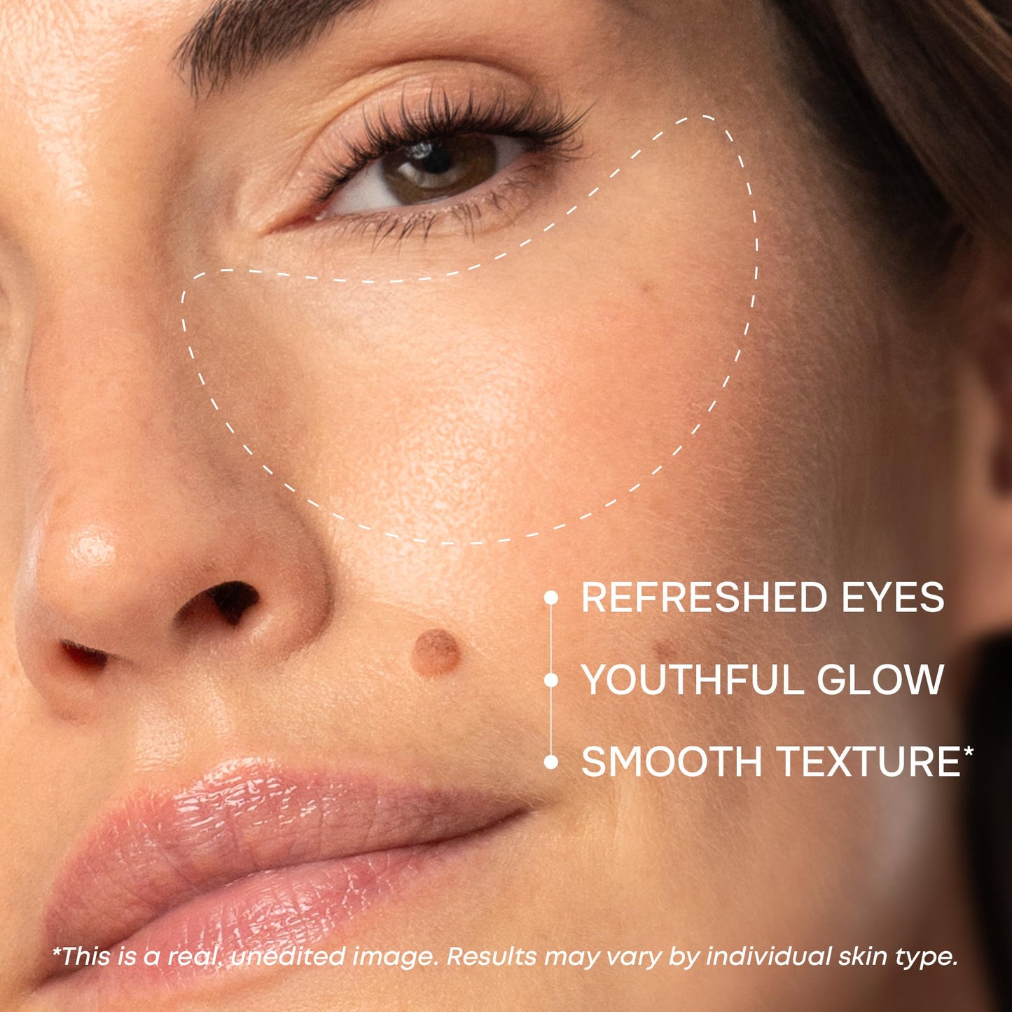 Under Eye Patches for Puffy Eyes and Dark Circles - Cooling Eye Masks for Women & Men with Collagen, Hyaluronic Acid & Retinol - Depuffing Undereye Mask Patches - Parches Para Ojeras - 15 Pairs