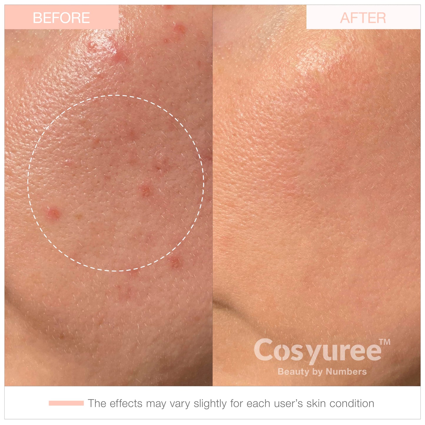 COSYUREE Collagen Deep Absorbing Hydrogel Mask (50g x 5ea) Korean Collagen Face Mask for Deep Hydration, Skin Firming, & Rejuvenation, Overnight Hydrating Gel with Pepta-18