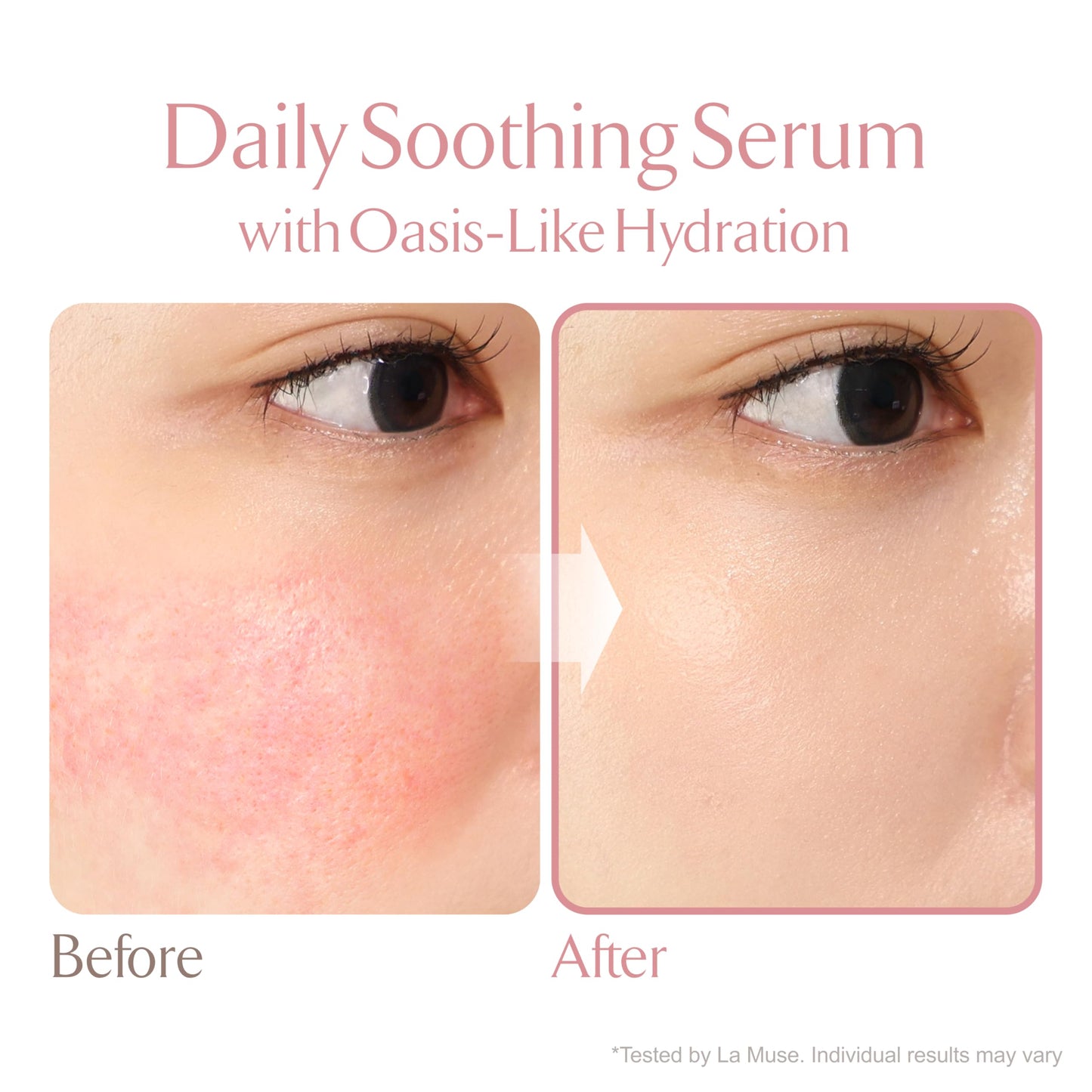 LA MUSE Oasis Soothing Serum(Pouch / 2.71 fl oz) | Gel Moisturizer for Face, Instant Soothing with Cica | Hydrolyzed Collagen, Hydro Boost for Deep Hydration & Radiance | Non-Sticky & Fast-Absorbing