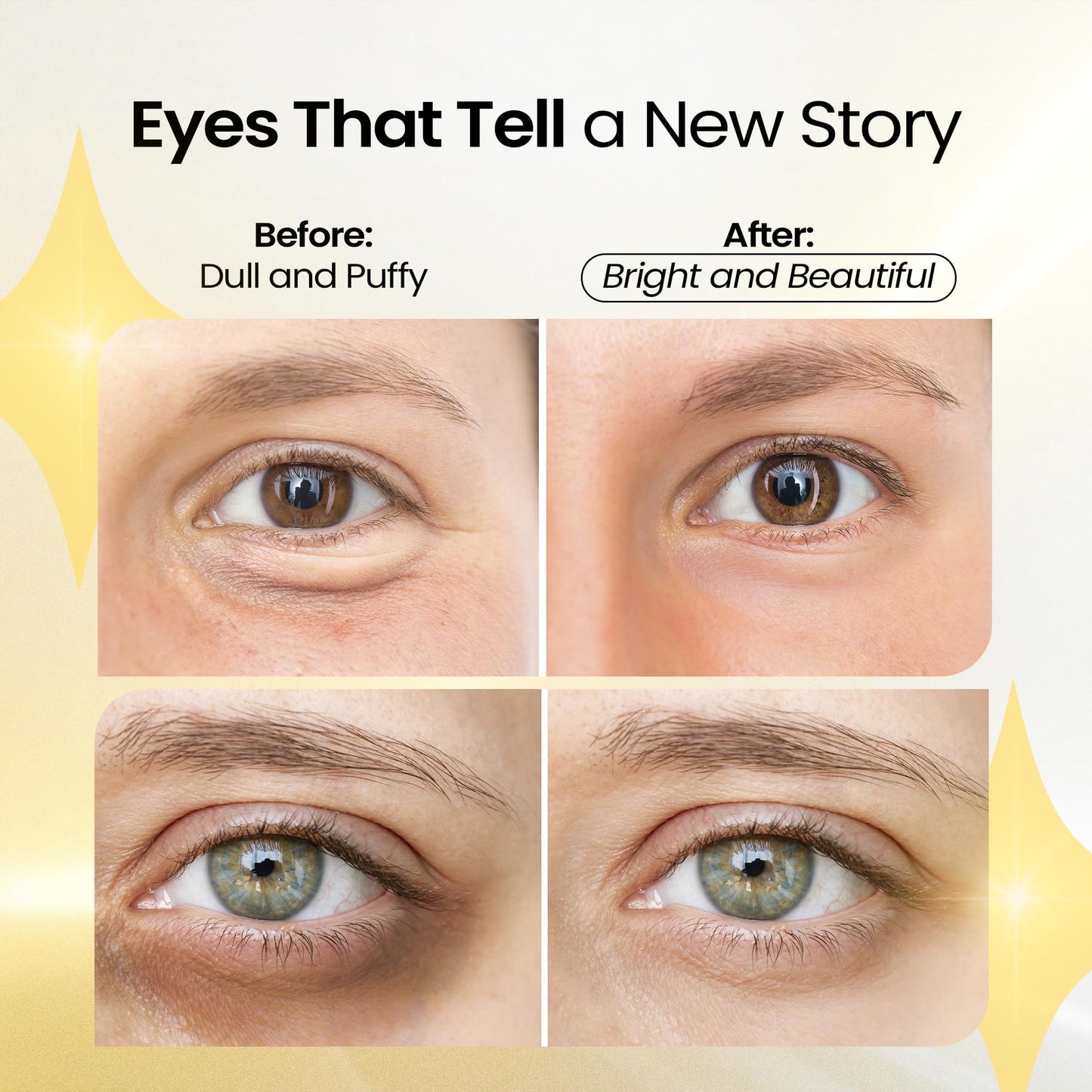 LA PURE 24k Gold Under Eye Mask for Dark Circles and Puffiness, Revitalizing & Non-Irritating Anti Aging Eye Patches with Hyaluronic Acid & Collagen - Dermatologically Tested - 15 Pairs Eye Gel Pads