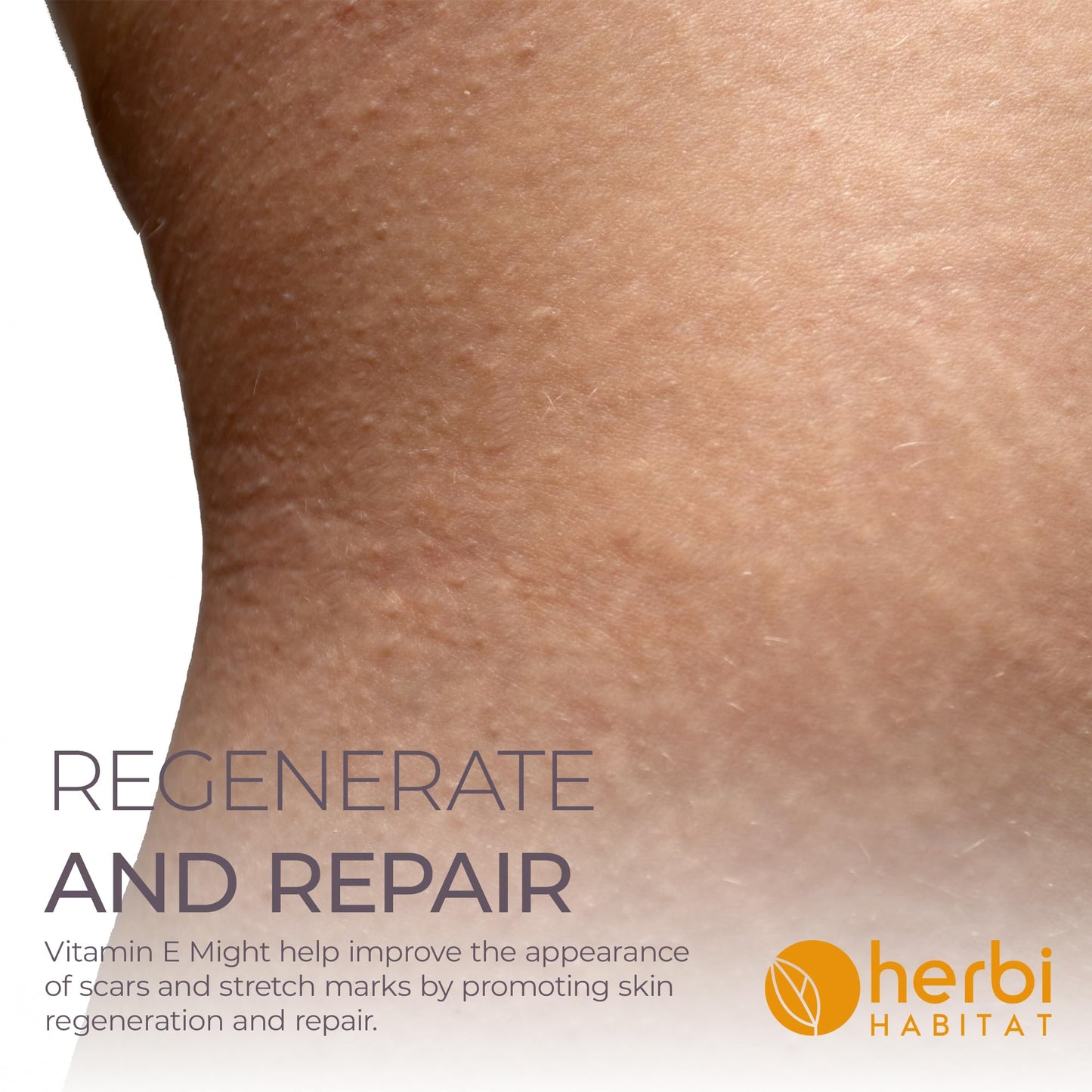 Herbi Habitat Vitamin E Oil 86,000 IU - Natural D-Alpha Tocopherol for Skin, Hair, Nails, Scars & Stretch Marks - Non-GMO & Vegan, 2 Fl oz