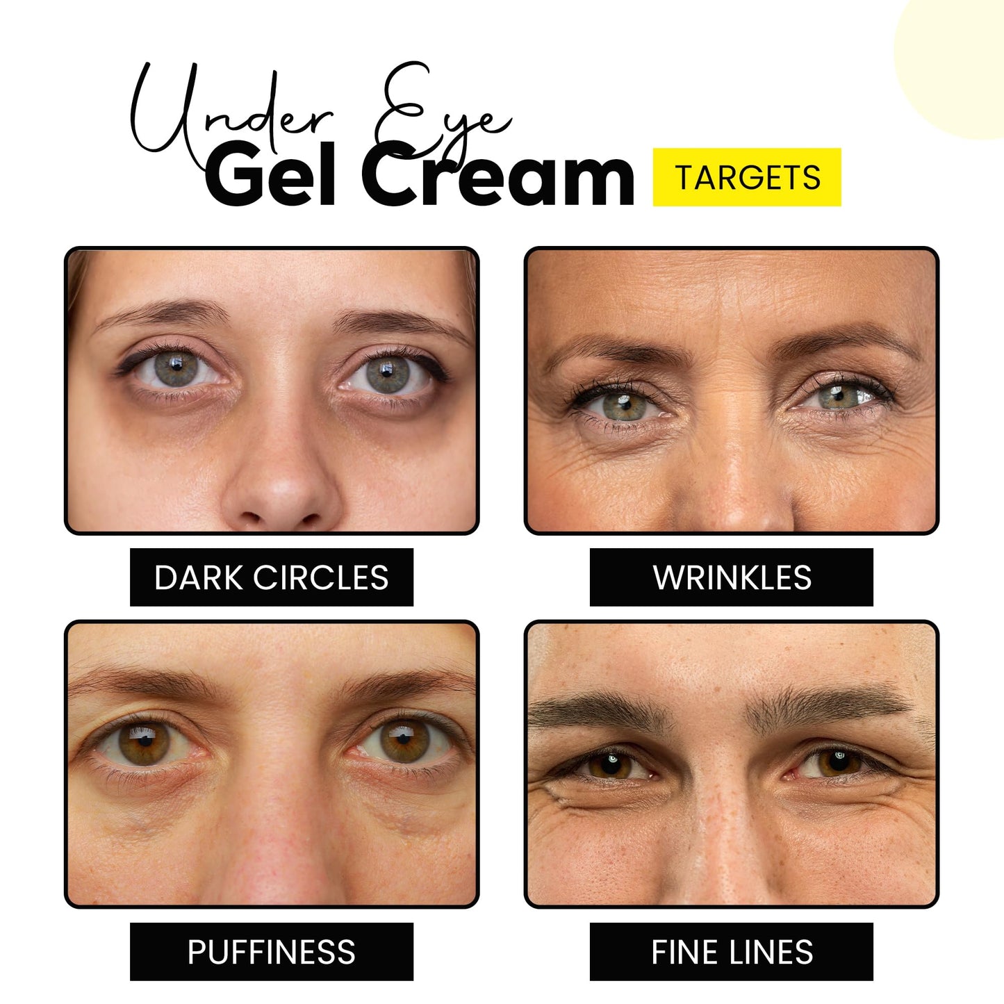 Masofta Under Eye Gel Cream with Retinol, Niacinamide, Caffeine, Vitamin C, & Aloe Vera Extract for Dark Circles, Fine Lines, and Puffy Eyes, For both Men & Women, 30ML