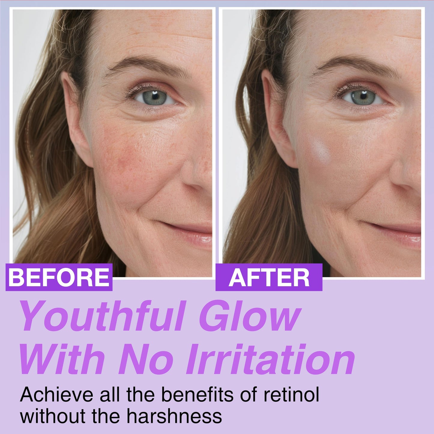 Korean Bakuchiol Concentrate DIY Mix-in Serum 30,000 ppm - High Potency Retinol Alternative | Wrinkle Reduction Skin Firming & Smoothing - Anti-Aging Sensitive Skin Vegan & Cruelty-Free Non-GMO 1 oz