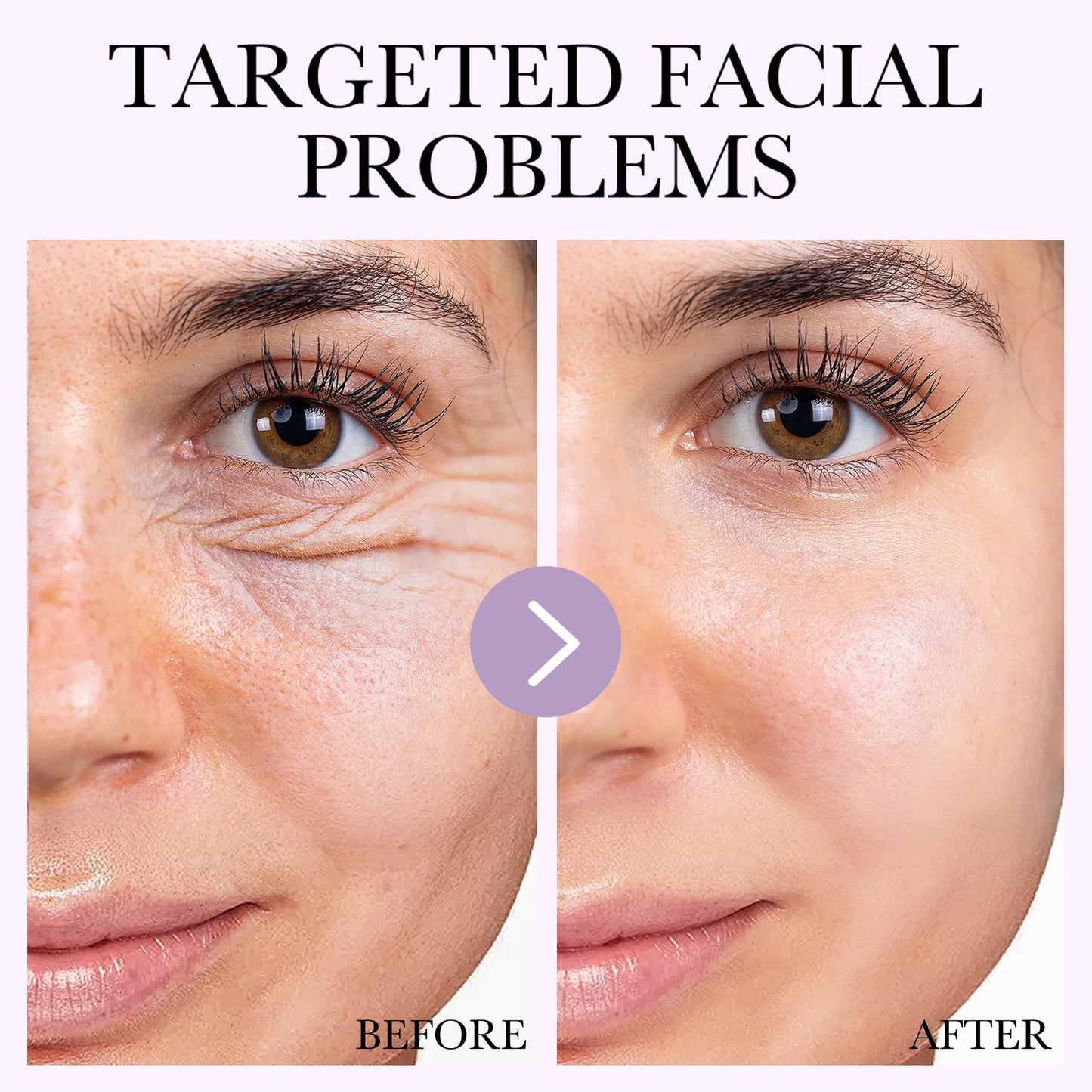 Deep Bio-Collagen Real Mask 34g*6ea, Facial Hydrogel Masks with Low Molecular Weight Collagen, Hydrating Overnight Mask for Moisturizing, Pore Minimizing, Firming, Elasticity, Wrinkle, Easily Absorbed