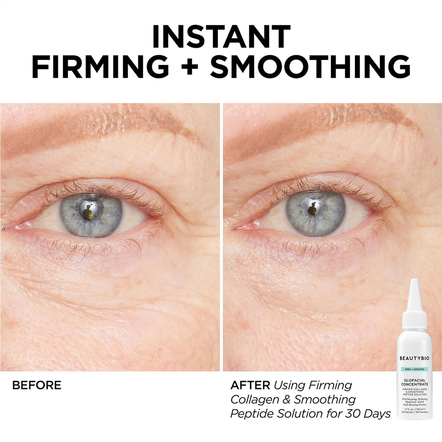 BeautyBio GLOfacial Hydro-Infusion Deep Pore Cleansing + Blue LED Clarifying Tool & Concentrates