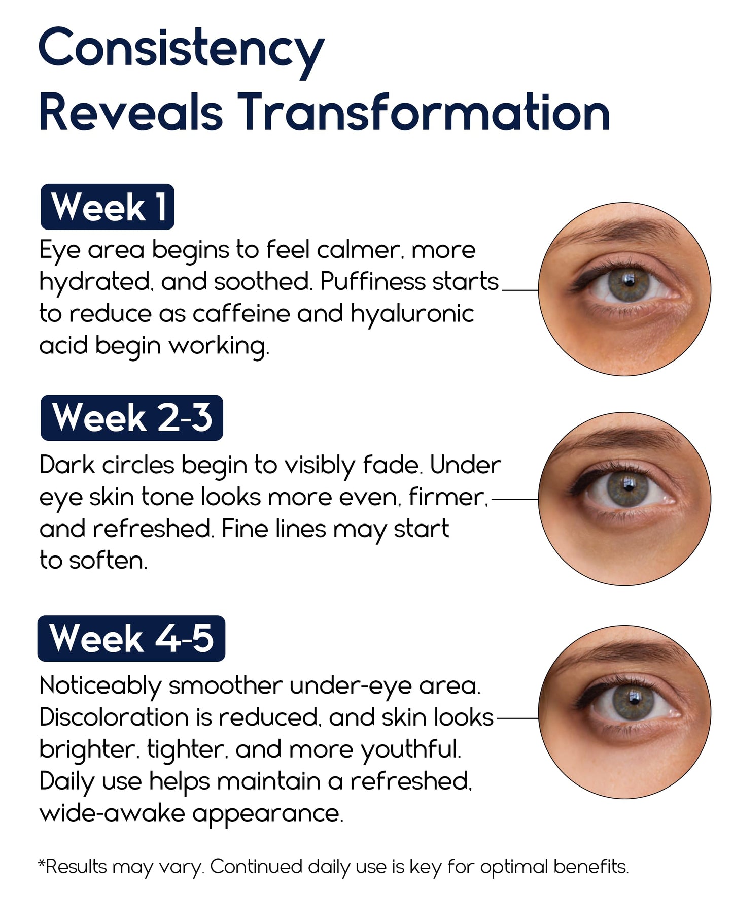 Under Eye Cream for Puffiness and Bags Under Eyes, Eye Bags Treatment for Men & Women - Anti Wrinkle Cream for Dark Circles, Baggy Eyes Treatment for Women with Retinol, Hyaluronic Acid & Caffeine