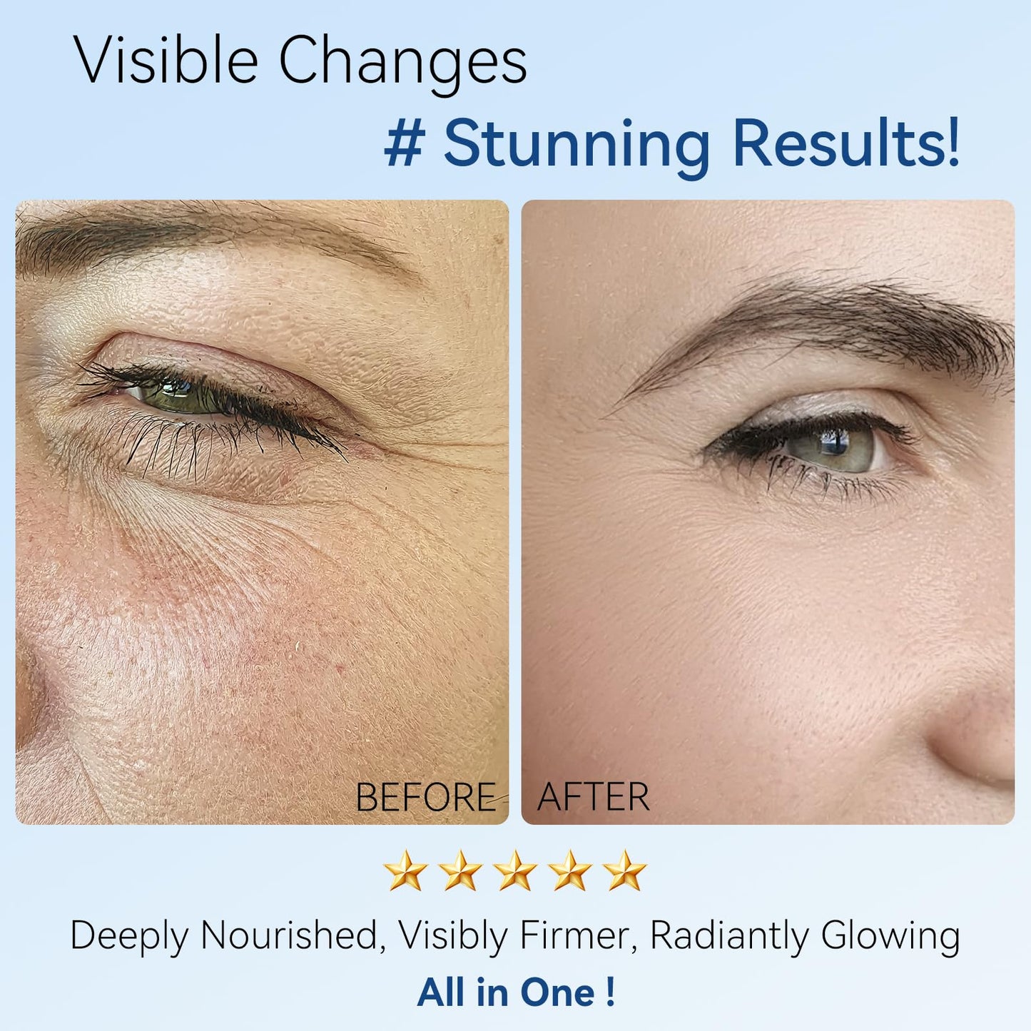 Retinol Moisturizer Face Cream with Collagen, Hyaluronic Acid – Anti Aging & Hydrating Cream for Face, Chest & Body – Instant Face Lift Cream, Neck wrinkle cream for Men & Women, 1.35 FL OZ