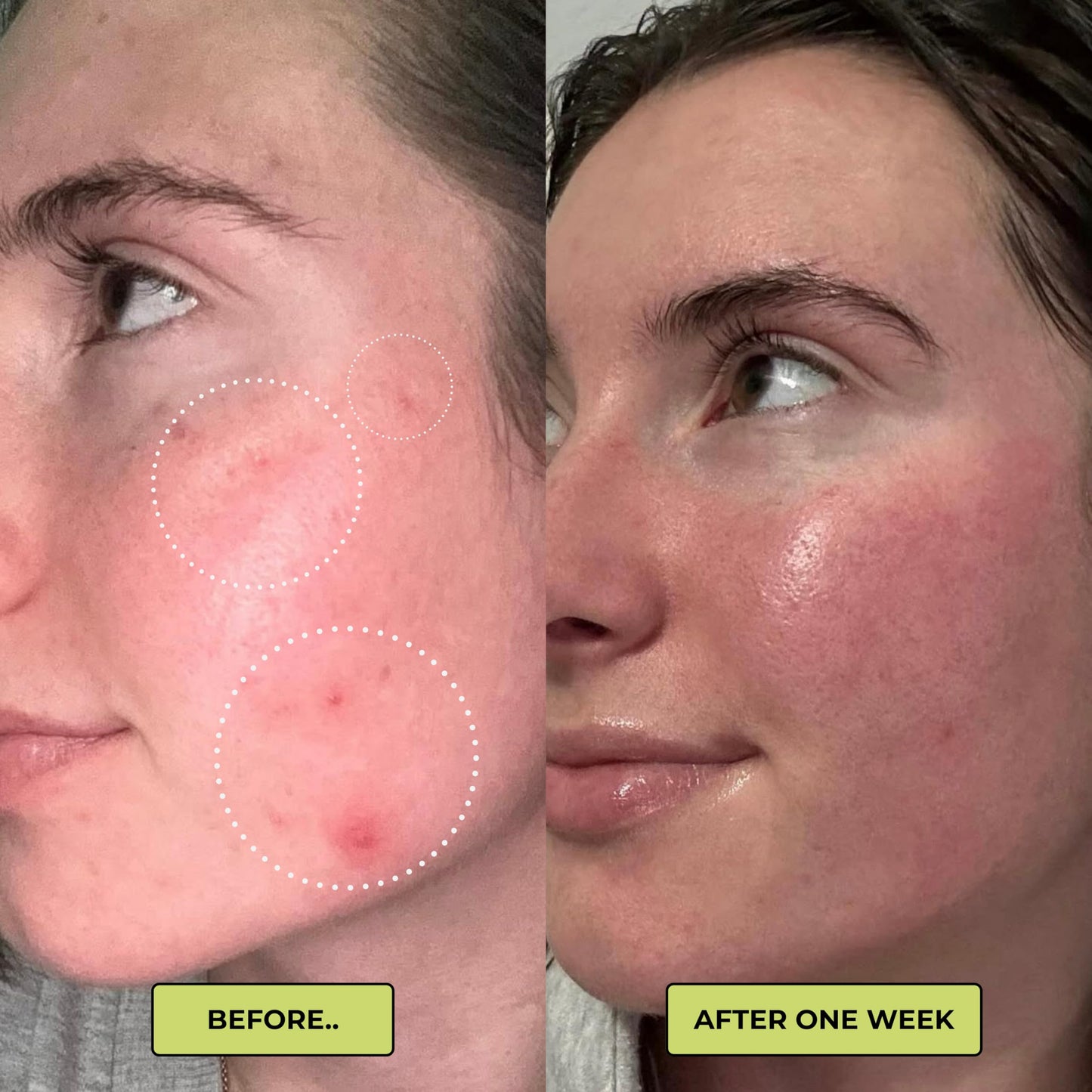 Natics Nourish Daily Face Moisturizer – Instant Hydration & Barrier Repair with Natural BHA & Prebiotics – Vegan, Cruelty-Free, TSA-Friendly Travel Size, for Sensitive, Oily & Acne-Prone Skin (1 oz)