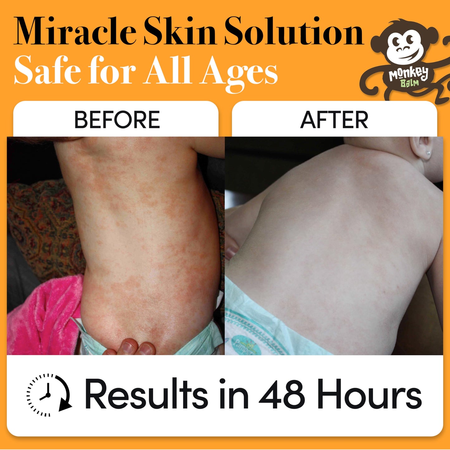 Monkey Balm All Natural Multi-Purpose Skin Solution (Safe for Babies & All Ages) Use on Dry, Cracked Skin, Irritation, Rashes, 0.6oz Healing Balm (2 Pack)