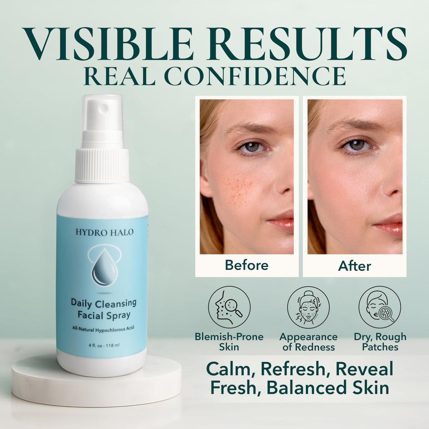 Hydro Halo Hypochlorous Acid Face Spray 4oz – Hydrating Facial Mist, Calm & Soothe Irritation, pH Balanced, No Alcohol, Daily Skin Care, Made in USA