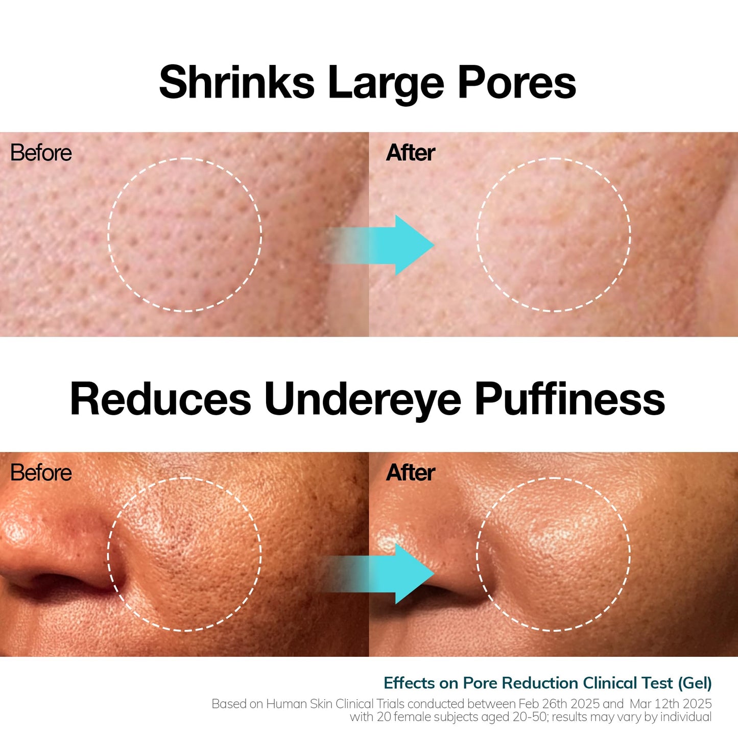 mimmua! Ice Sorbet Soothing Cooling Face Moisturizer | Pore Minimizer for Face Before Makeup | After Sun Care for Sunburn, Heat Rash & Calming Gel Cream After Shower | Korean Skincare | 3.38 Fl Oz