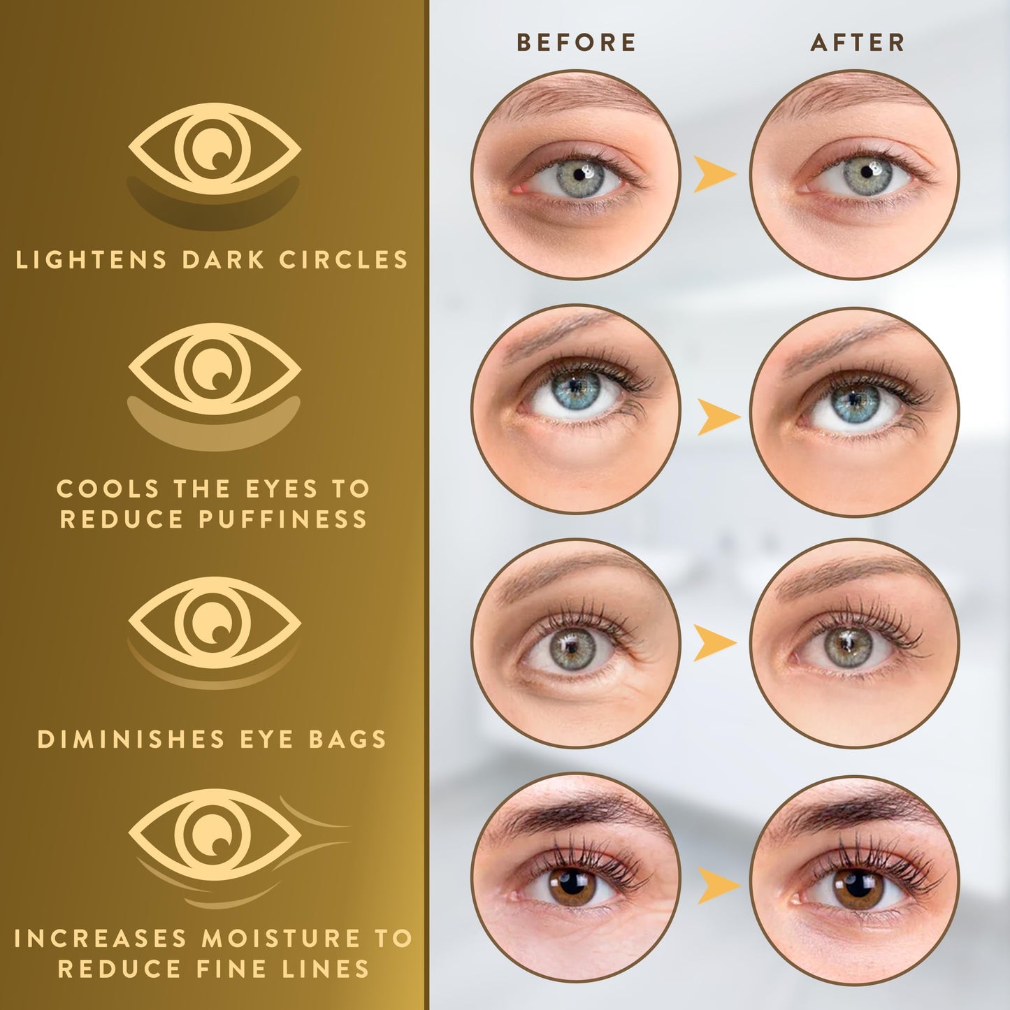 Live Wild Beauty Under Eye Patches (72 Patches) for Puffy Eyes and Dark Circles with Pure Collagen, 24K Gold Eye Gel Pad Masks for Reducing Eye Bags, Puffy Dark Circles, Wrinkles, and Fine Lines