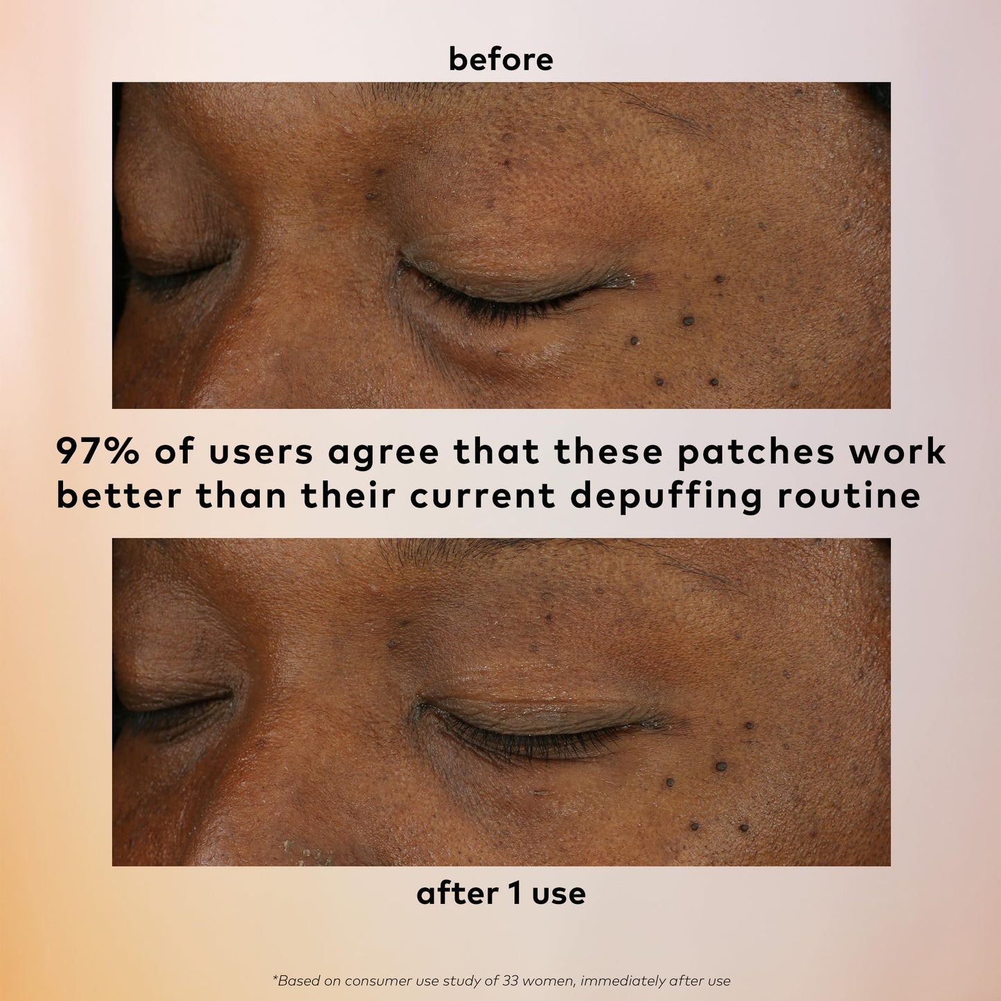 The Good Patch De-Puff Cooling Hydrogel Under Eye Patches for Puffy Eyes and Under Eye Bags, Made with Caffeine, Aloe Vera, Gotu Kola, Clinically Proven (6 Total Patch Sets)