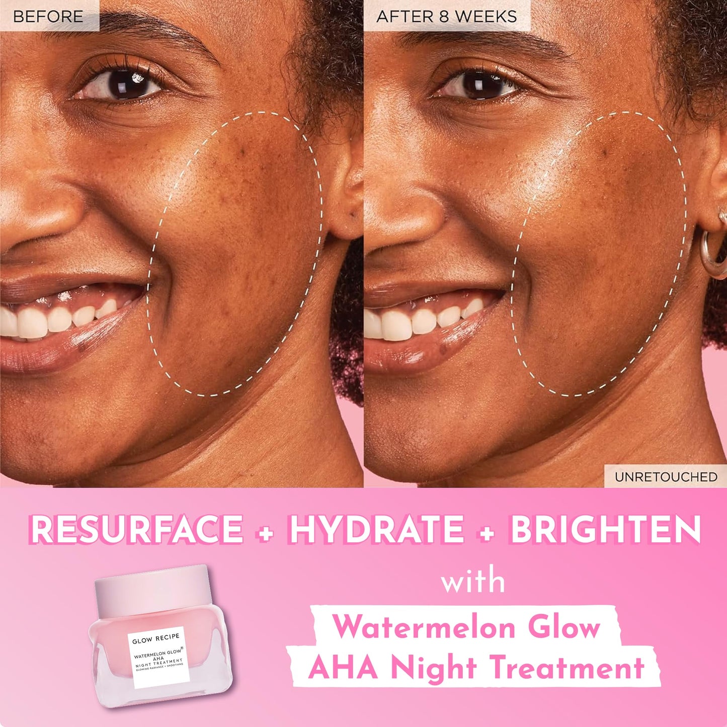 Glow Recipe Travel Size Watermelon Glow AHA Night Treatment - Overnight Resurfacing Mask with AHA Complex, Hyaluronic Acid, Niacinamide & Watermelon Enzymes for Smooth, Glowing, Even-Toned Skin (25ml)