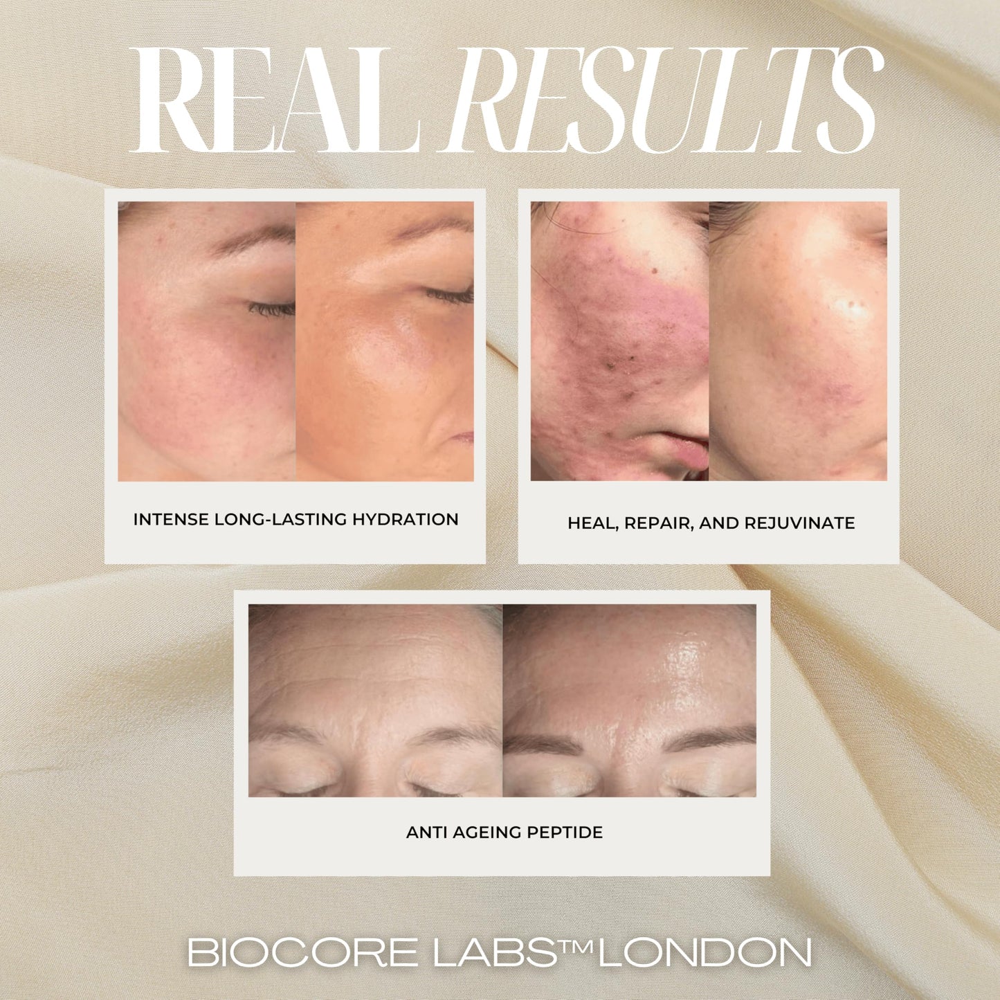 Advanced 3 IN 1 SNAIL MUCIN SUPER SERUM infused with FACELIFT Peptide by BIOCORE LABS™ Plumping,Moisturizing,Healing Serum for face 100ml 3.38 FL. OZ.