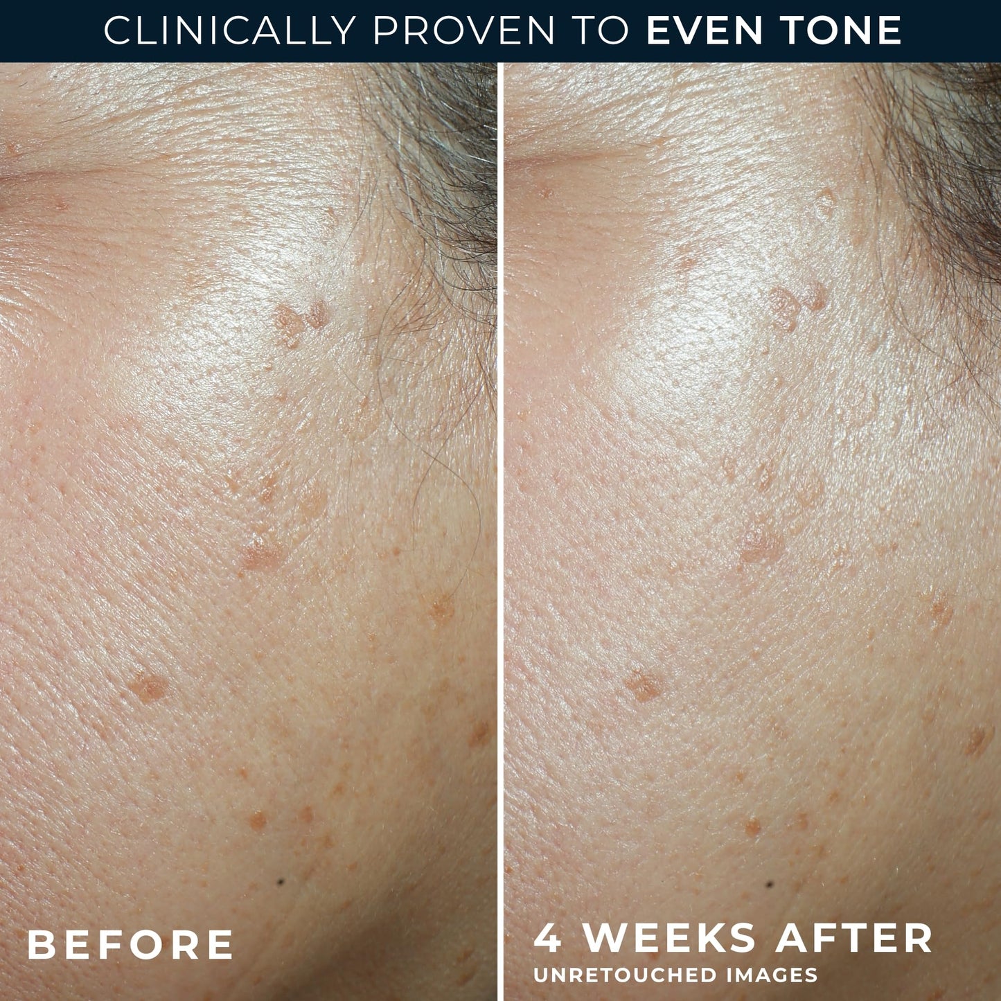 RoC Multi Correxion 5 in 1 Anti-Aging Daily Facial Moisturizer for Women and Men, Broad Spectrum SPF 30 & Shea Butter (1.7 oz) with Night Cream Packette (Packaging May Vary)