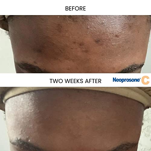 Neoprosone, Vitamin C Serum for Face | 1 Fl oz / 30ml | Brightening Serum For Dark Circle, Wrinkles | with Alpha Arbutin and Castor Oil