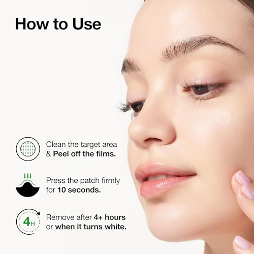 Anua Triple Acid Spot Care Microdart Patch, Deep, Early Stage Spot, 200+ Microdarts with AHA + BHA + PHA, Centella, Hydrocolloid Patch for Overnight, Non-Comedogenic, Korean Skin Care (12ea)