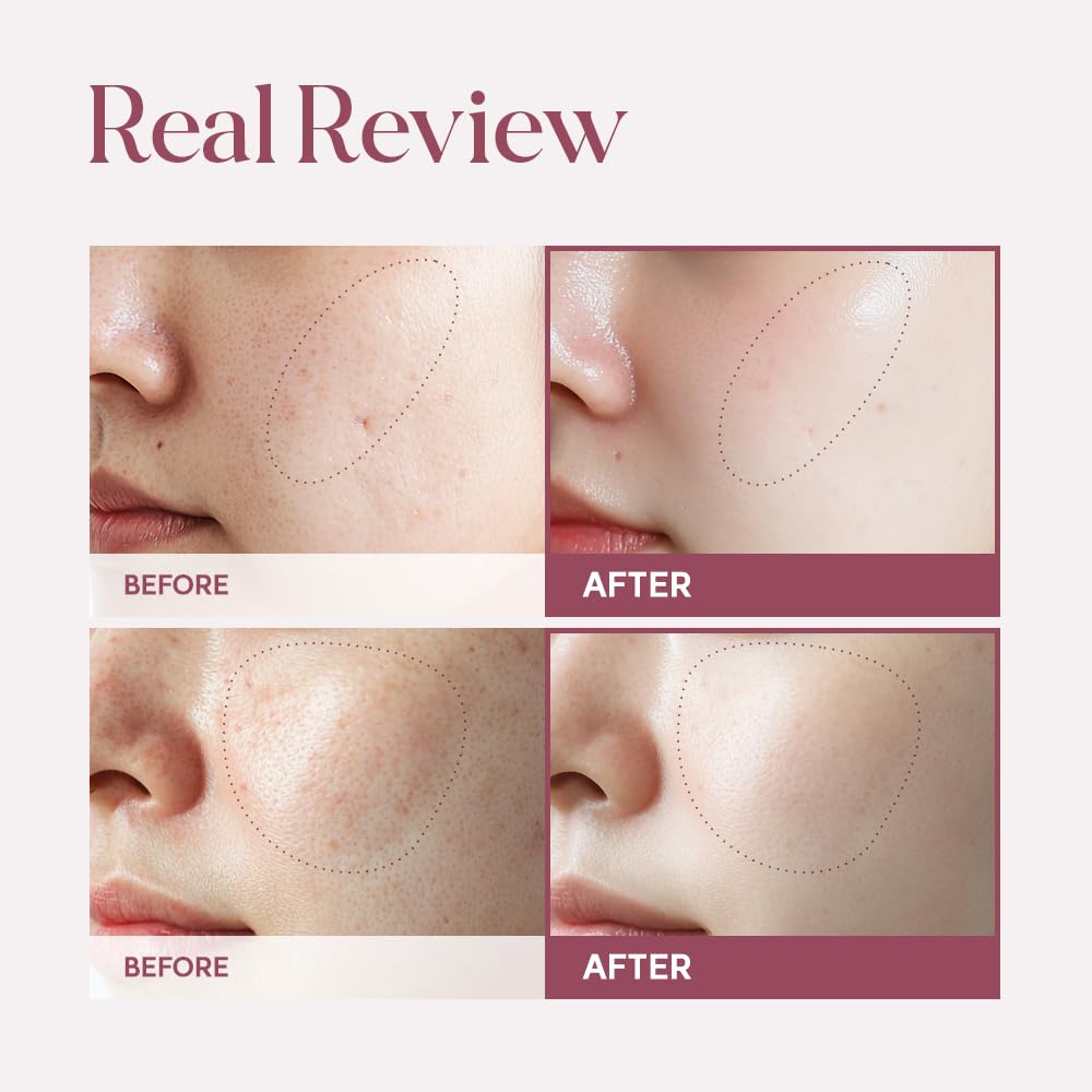 Lulubeu Skin Transforming Serum with NK Cell Technology, Hydrating Serum for Skin Elasticity & Smooth Texture, 1.69 fl oz