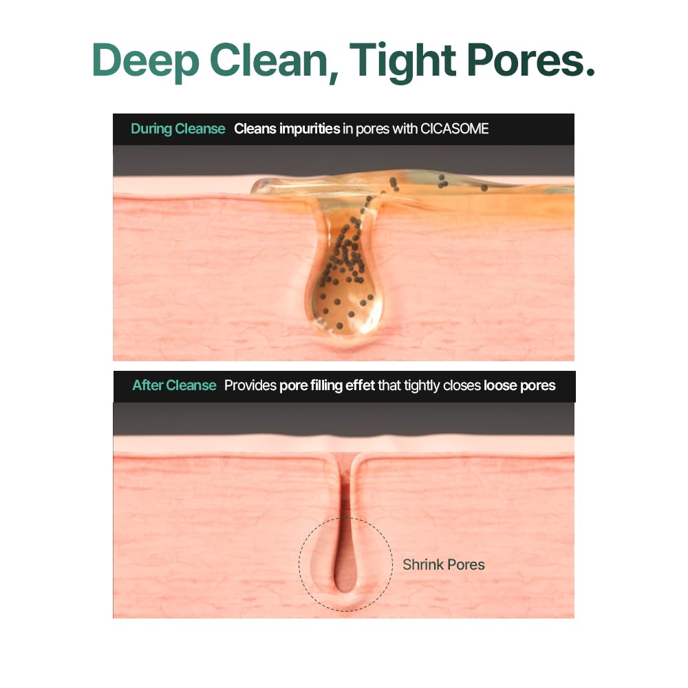 CELORABY Potension Pore Tightening Boost Serum - Advanced Korean Skincare Pore Minimizer with Exosome Technology, Targets Excess Sebum & Impurities (1.01 fl.oz)