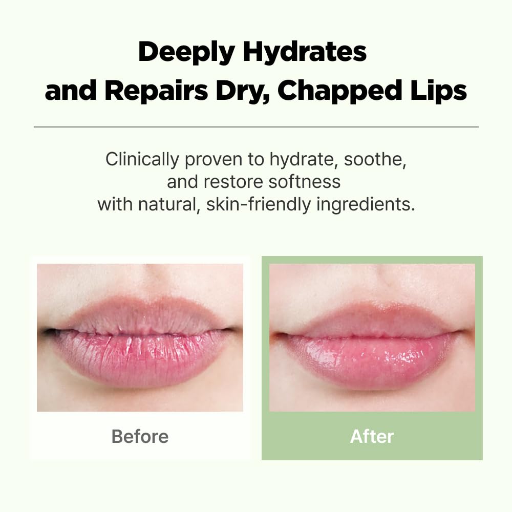 CICAGO Cica Lip Balm, Daily Hydrating Lip Balm for Dry & Chapped Lips, Deep Moisture & Soothing Cica Care, Korean Skin Care (0.34 fl. oz, 10g)