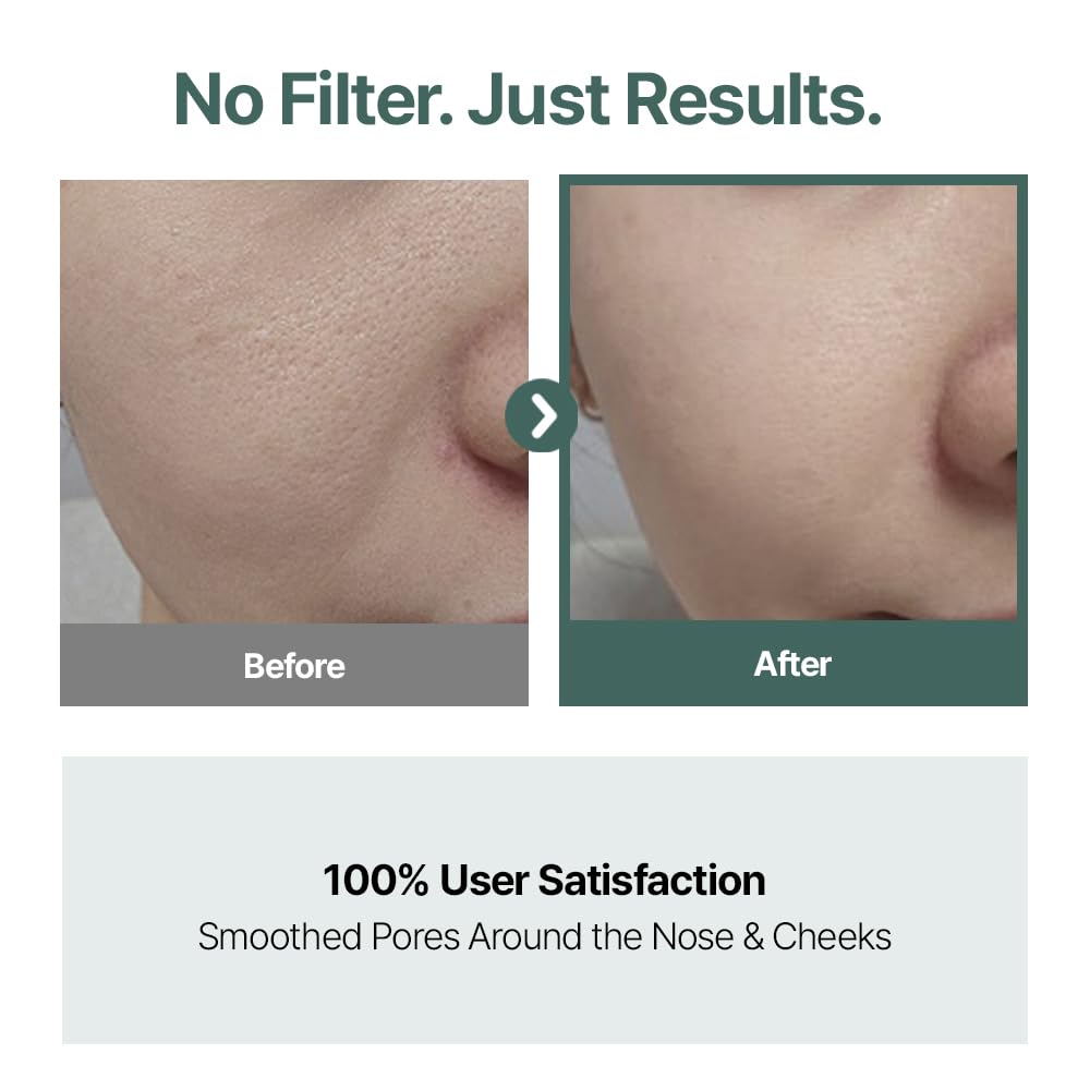 CELORABY Potension Pore Tightening Boost Serum - Advanced Korean Skincare Pore Minimizer with Exosome Technology, Targets Excess Sebum & Impurities (1.01 fl.oz)