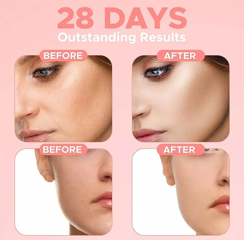 Collagen Retinol & Hyaluronic Acid Face Cream – Anti-Aging Wrinkle Repair Moisturizer for Face, Neck & Décolleté – Deep Hydration & Firming – Made in USA – 1.7 fl oz