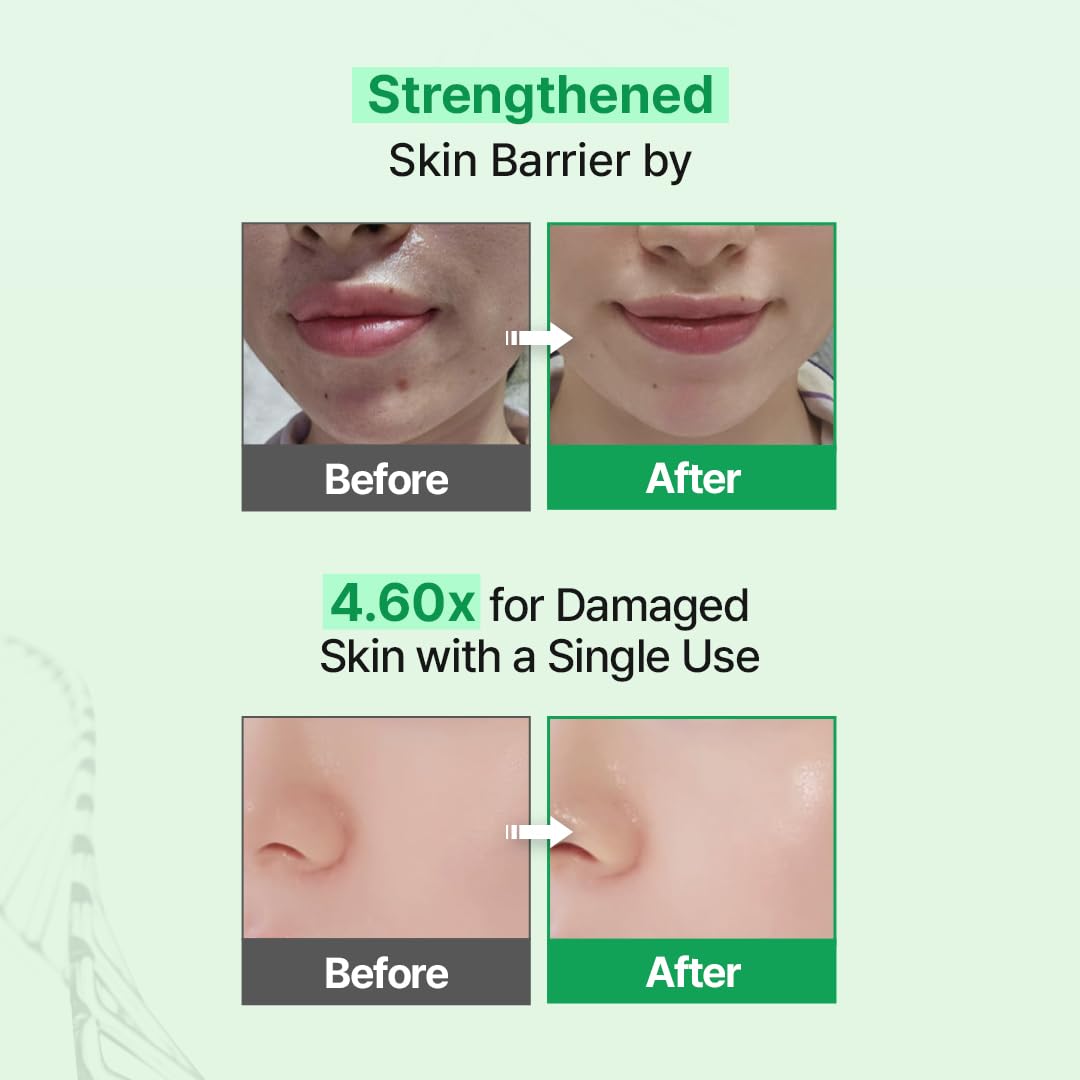 Zipiderm EGF Skin Barrier Hydro Ampoule with 5 CERAMIDE, PDRN & Niacinamide – Korean Barrier Repair Face Serum for Sensitive or Damaged Skin, Lightweight Hydrating Ampoule, 1.01 fl oz