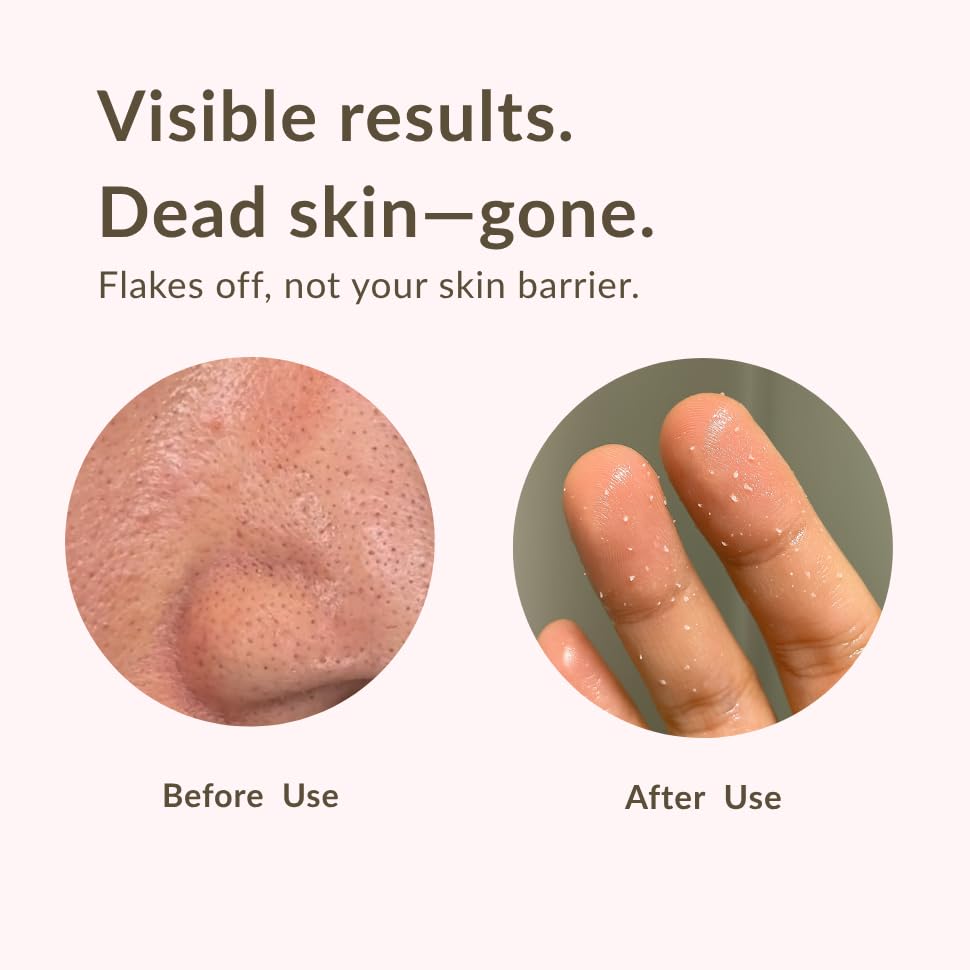 aplin Pink Tea Tree Cleansing Oil, Oil Cleanser for Face, Makeup Blackhead Remover, Korean Skin Care 6.76 fl oz(200ml)