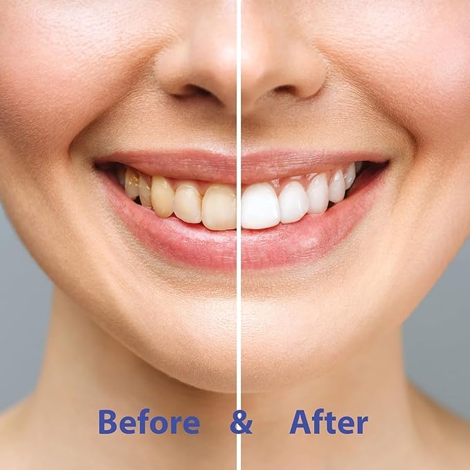 Chomp Super Whitening Spearmint Toothpaste Tablets with Nano Hydroxyapatite