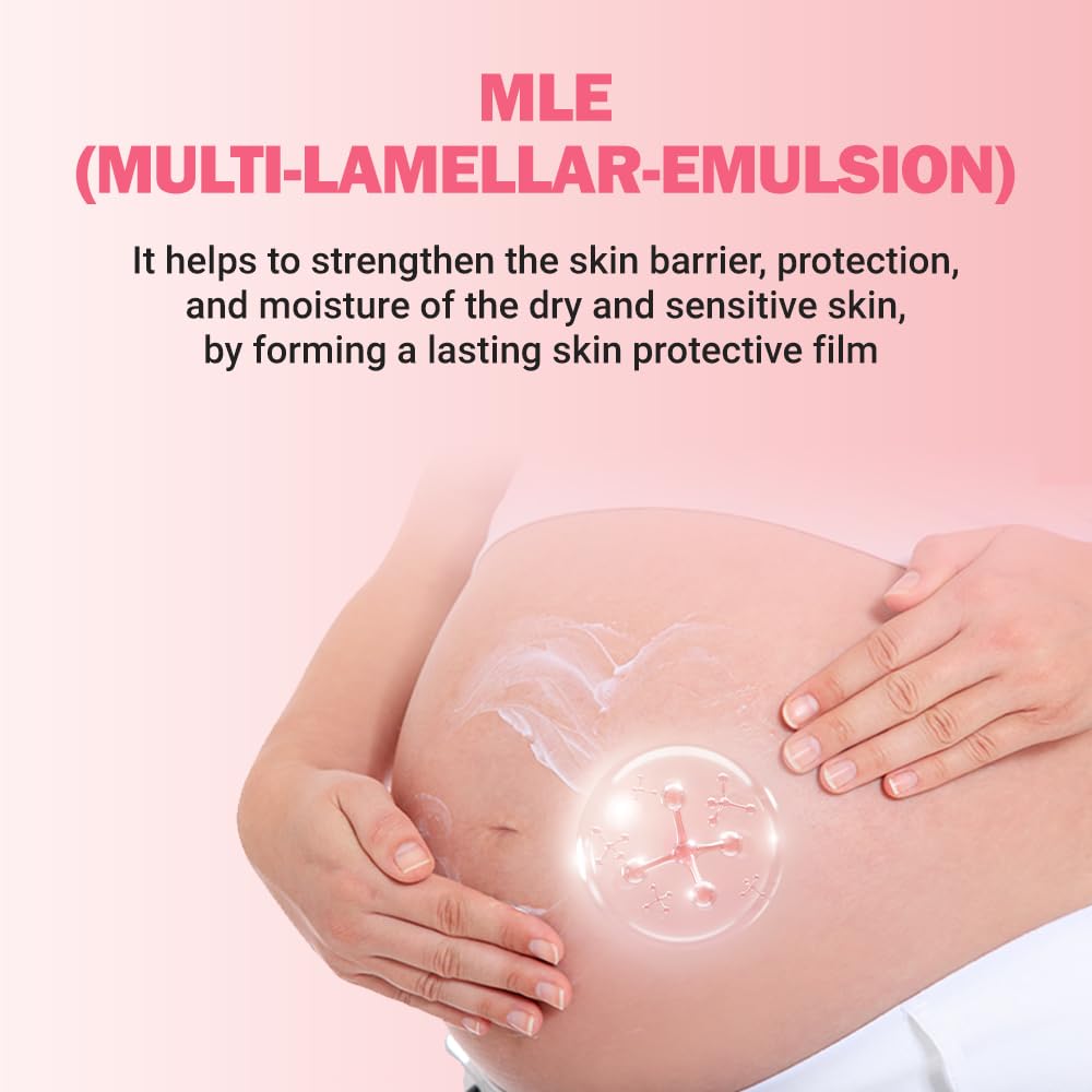 ATOPALM Maternity Care Stretch Mark Cream, 150ml 5 Fl Oz, Canola Oil Postpartum Skin Care| Pregnancy Red Lines Relief | Skin Swelling Elasticity Improvement| Gentle Body Moisturizing | Kbeauty