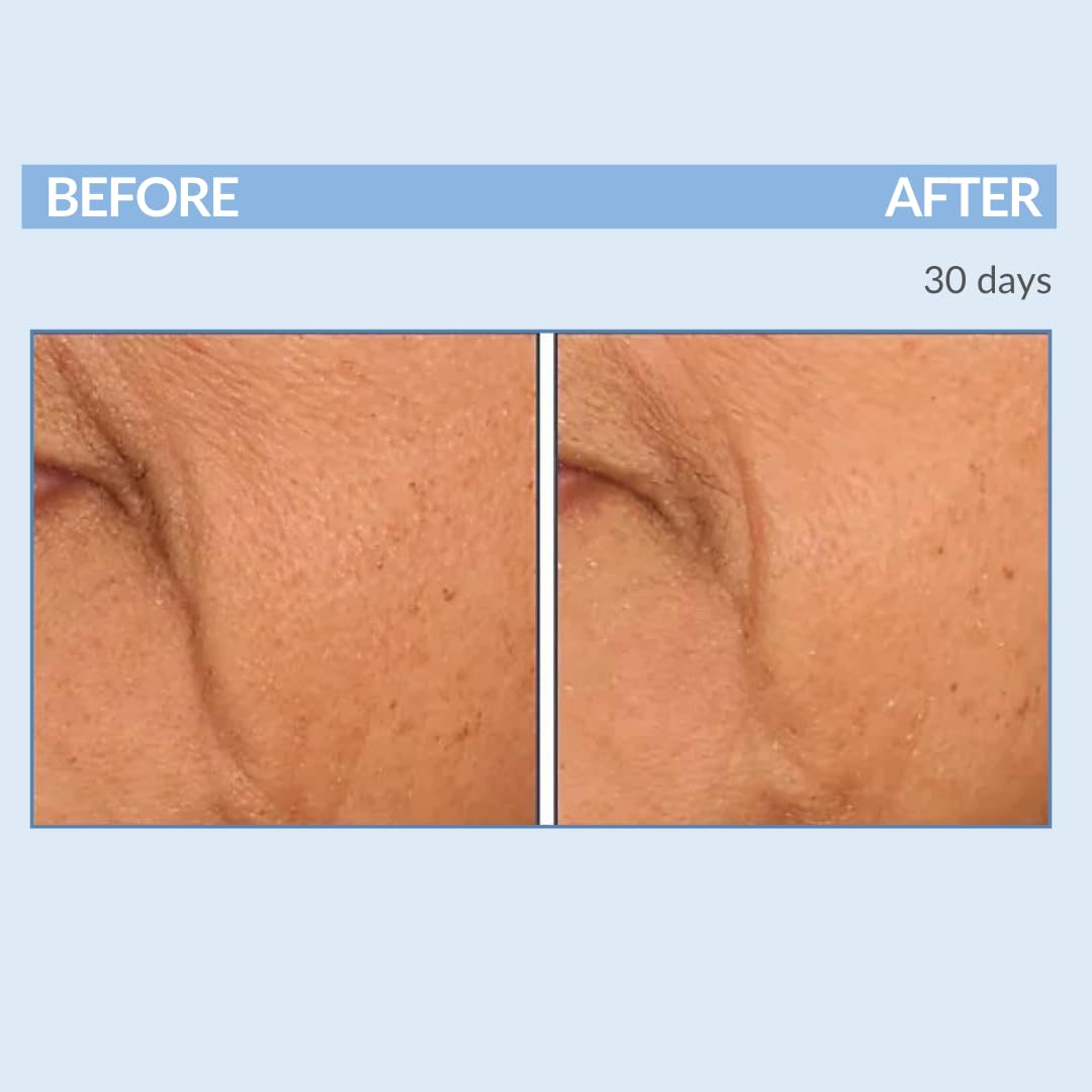 Retinol Fine Lines and Wrinkles Skin Care Set - A Force XR Serum and A Cream XR Moisture Cream for Face - Anti-Aging - Minimize Post Acne Marks - Resurface and Hydrate - Serious Skincare