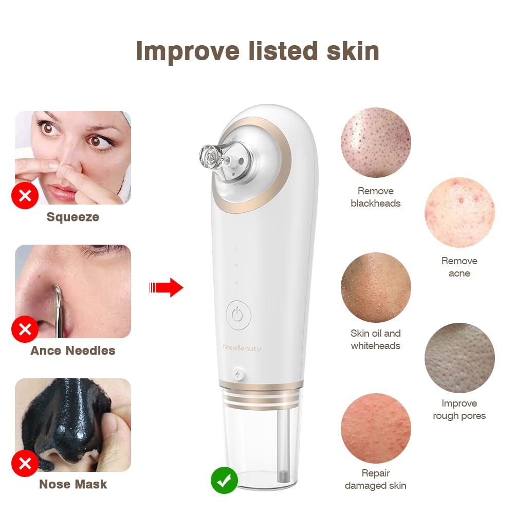 KinseiBeauty Electric Blackhead Remover Vacuum,Facial Suction Pore Cleanser, Acne Comedone Whitehead Blackhead Extractor Tool with 4 Removable Suction Heads,3 Suction Modes for Women and Men