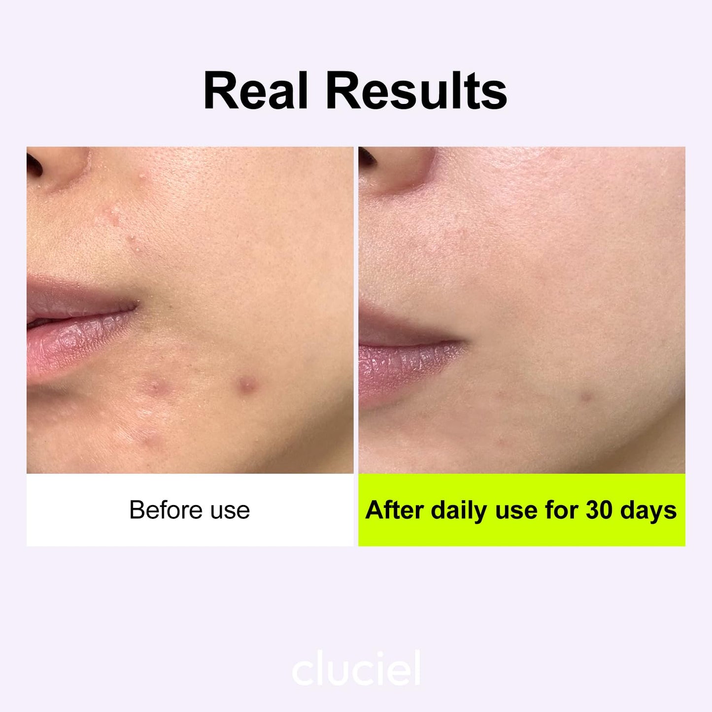 cluciel Niacinamide Peptide Serum I Repairing Serum, Targets Dullness, Dark Spots, Hyperpigmentation, Blemishes, Pore Care, Korean Glass skin (50ml / 1.69 fl.oz)