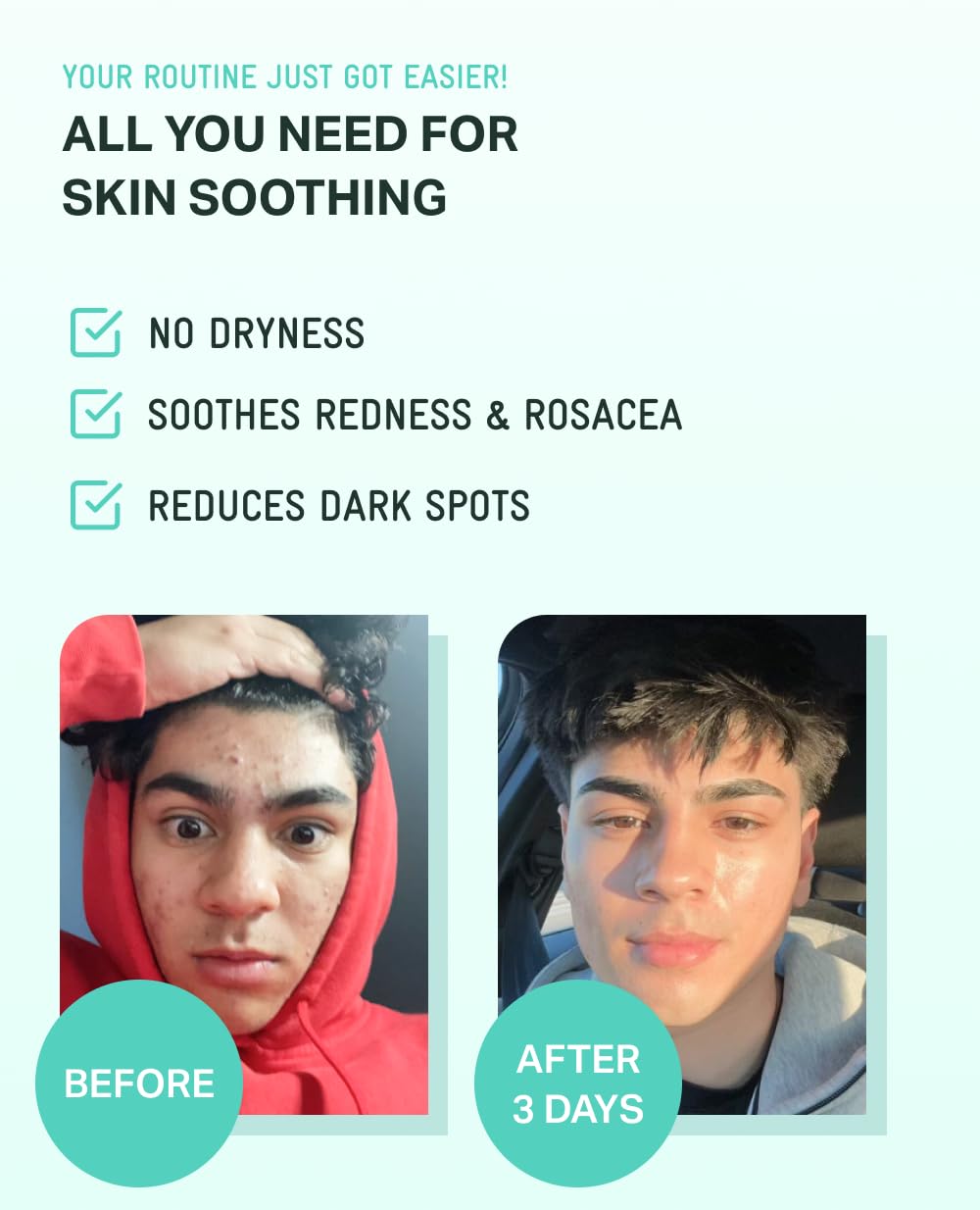 BRING GREEN ZINC TECA Serum with Niacinamide | Soothing Face Serum for Sensitive Skin, Pore Minimizing & Hydrating | Korean Skincare for Breakouts & Uneven Texture