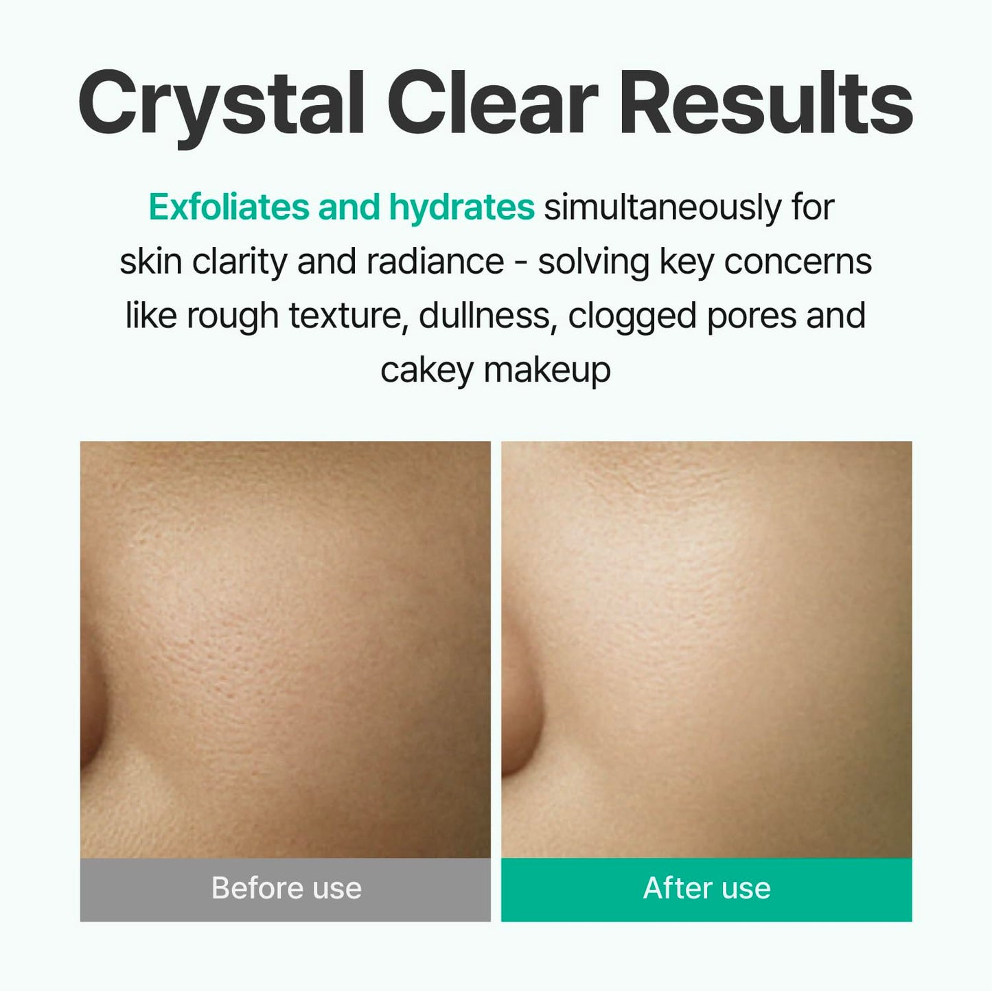 Centellian 24 AHA Aqua Peeling Boosting Ampoule (AHA Peeling Ampoule, 1.01fl oz) - Gentle Exfoliating & Hydrating Serum with AHA Complex, Refines Pores & Enhances Skin Clarity, Korean Skin Care