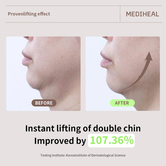 Mediheal Retinol Collagen Cream Lifting Mask (4 Counts) for V Line Mask,Anti-Aging - Helps Reduce Fine Lines & Wrinkles, and Smoothens Skin