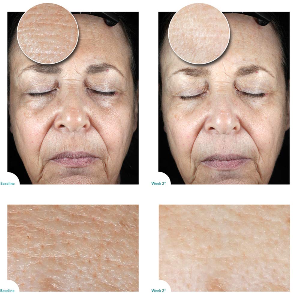 Aquareveal Satin Bright Soft Water Peel for Face , exfoliator for anti-aging, acne, dry, oily, sensitive skin, eczema , 95% organic/natural Korean peeling gel/gommage , large 100 ml/3.4 Fl Oz size